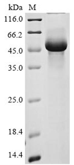 (Tris-Glycine gel) Discontinuous SDS-PAGE (reduced) with 5% enrichment gel and 15% separation gel.