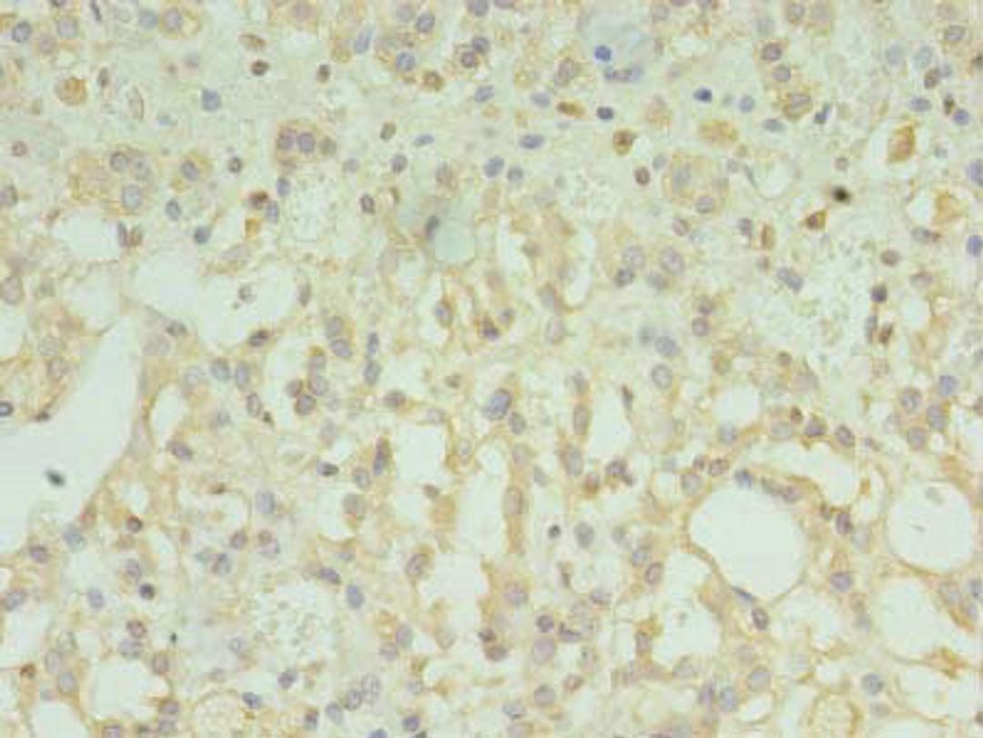 Immunohistochemistry of paraffin-embedded human adrenal gland tissue using CSB-PA023829LA01HU at dilution of 1:100