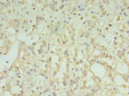 Immunohistochemistry of paraffin-embedded human adrenal gland tissue using CSB-PA023829LA01HU at dilution of 1:100