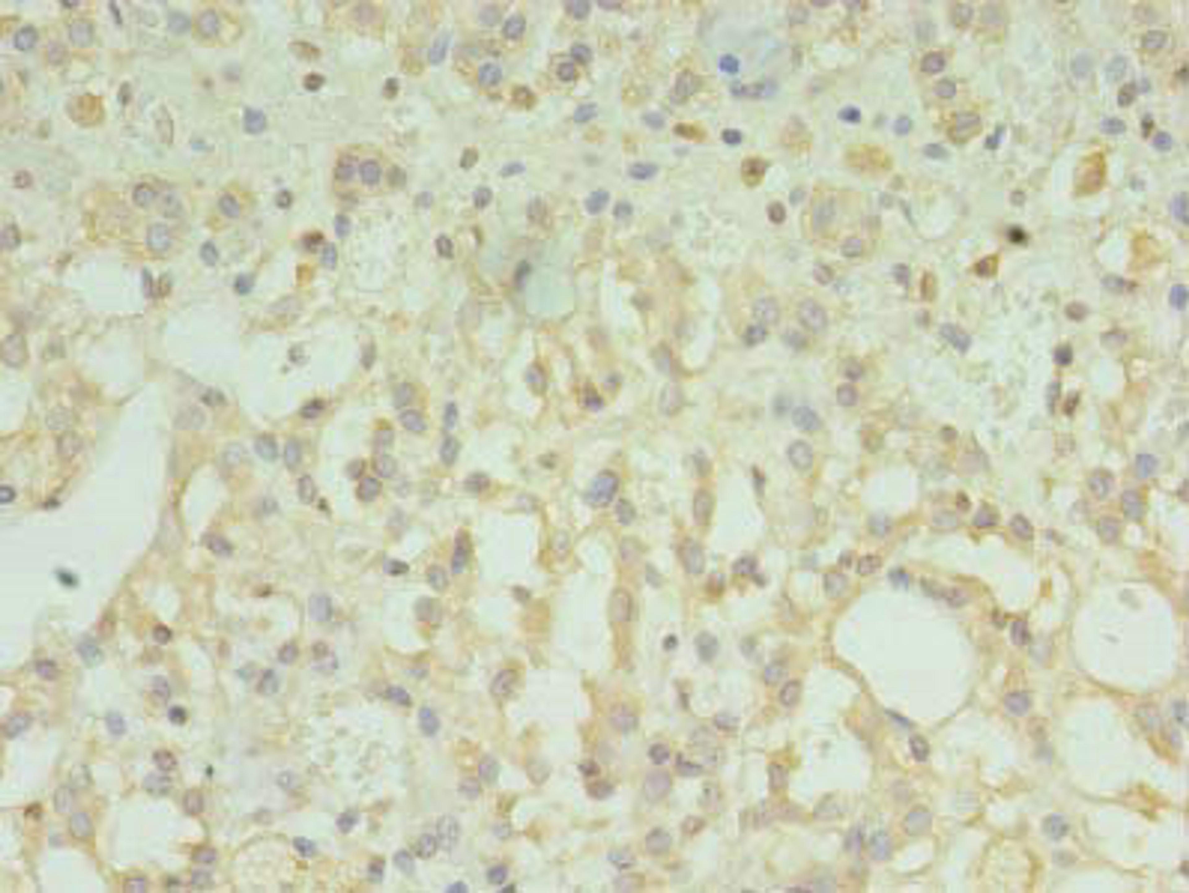 Immunohistochemistry of paraffin-embedded human adrenal gland tissue using CSB-PA023829LA01HU at dilution of 1:100