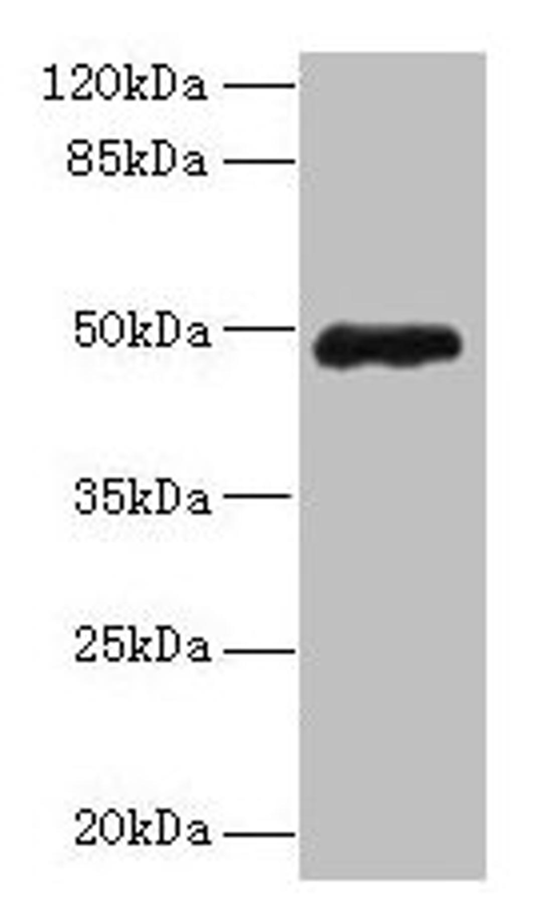 Western blot. All lanes: ZNF562 antibody at 12µg/ml + 293T whole cell lysate. Secondary. Goat polyclonal to rabbit IgG at 1/10000 dilution. Predicted band size: 49, 41 kDa. Observed band size: 49 kDa