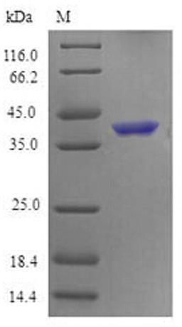 (Tris-Glycine gel) Discontinuous SDS-PAGE (reduced) with 5% enrichment gel and 15% separation gel.