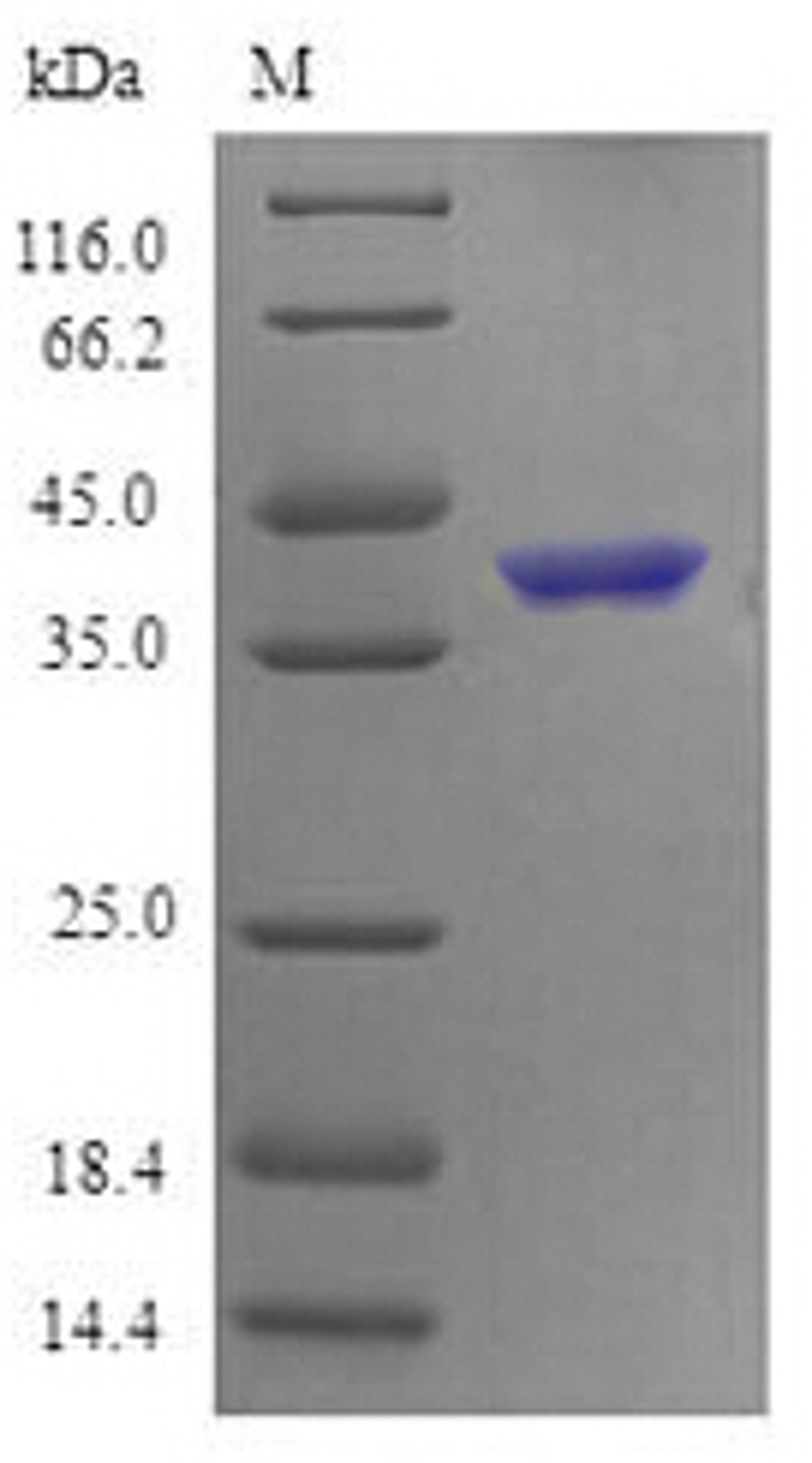 (Tris-Glycine gel) Discontinuous SDS-PAGE (reduced) with 5% enrichment gel and 15% separation gel.