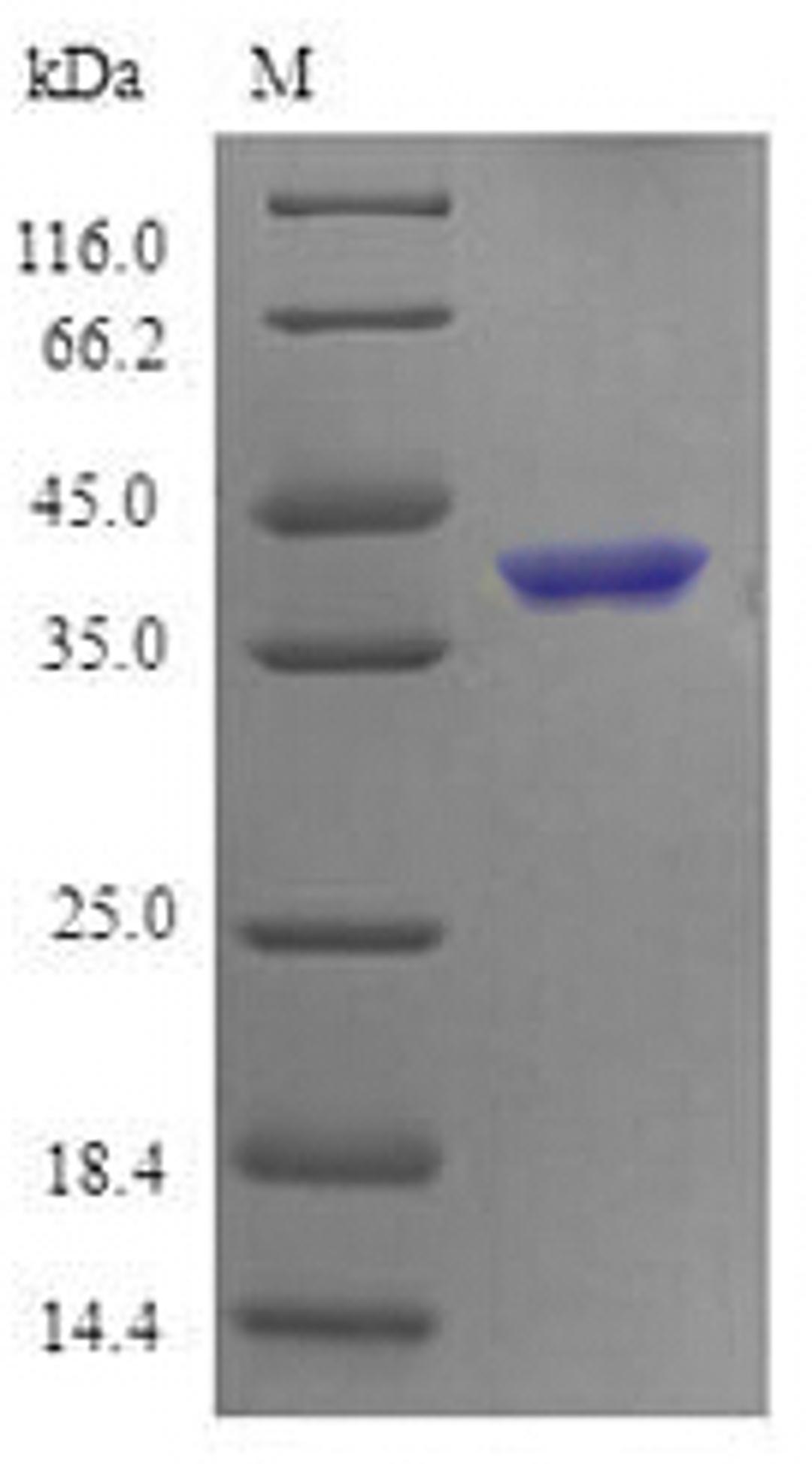 (Tris-Glycine gel) Discontinuous SDS-PAGE (reduced) with 5% enrichment gel and 15% separation gel.