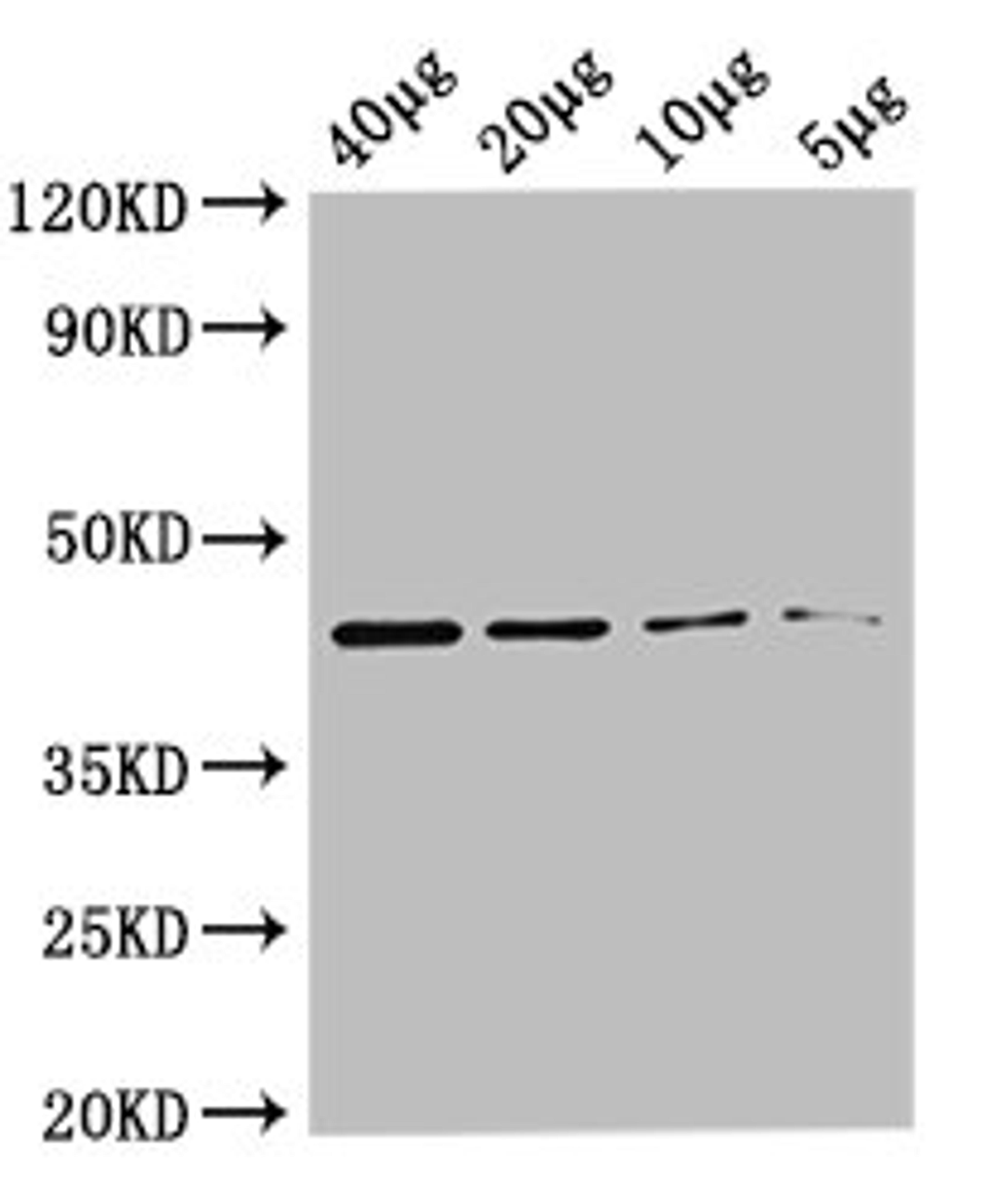 Western Blot. Positive WB detected in: Rosseta bacteria lysate at 40µg, 20µg, 10µg, 5µg. All lanes: metC antibody at 0.36µg/ml. Secondary. Goat polyclonal to rabbit IgG at 1/50000 dilution. Predicted band size: 44 kDa. Observed band size: 44 kDa
