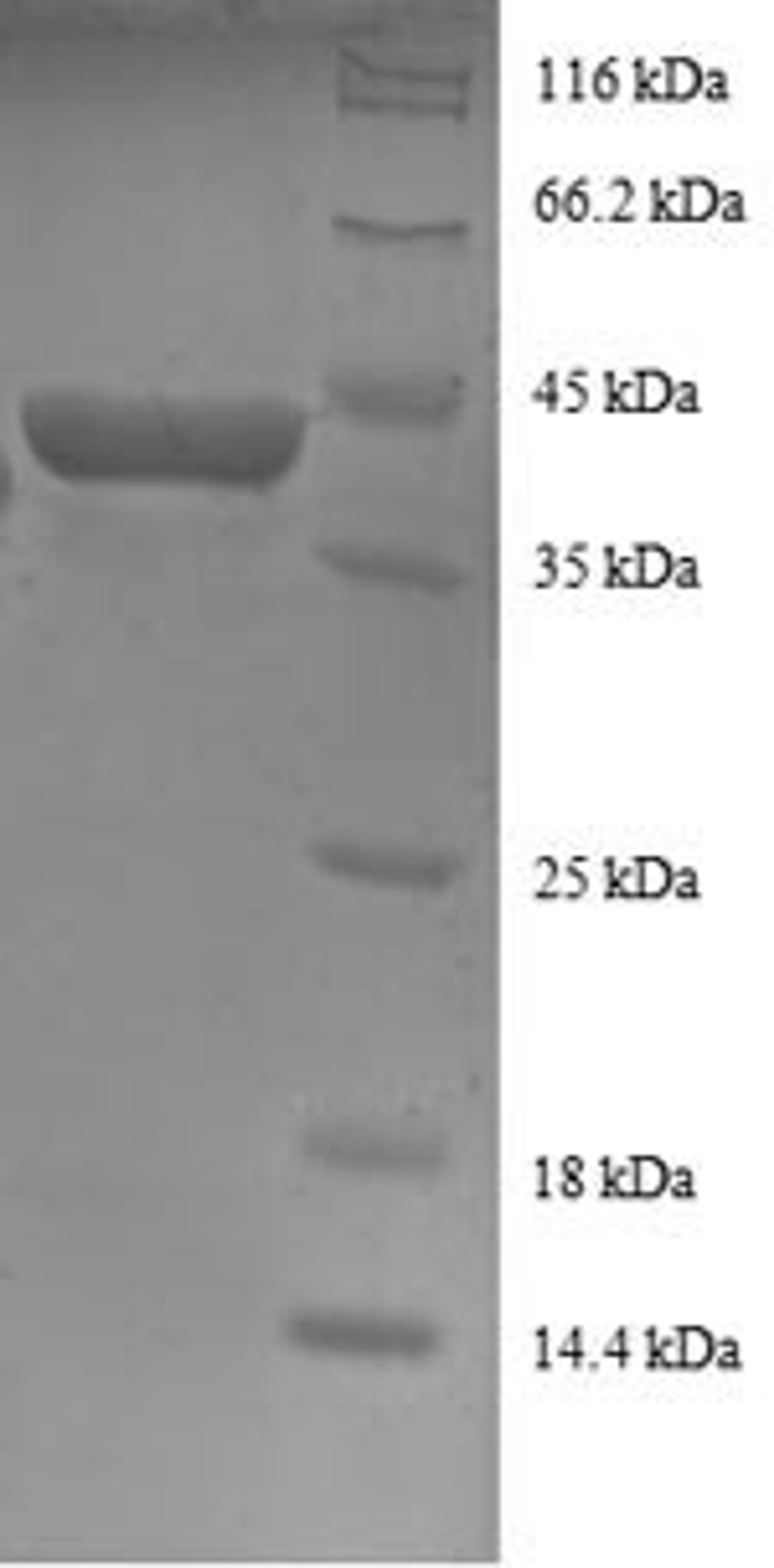 (Tris-Glycine gel) Discontinuous SDS-PAGE (reduced) with 5% enrichment gel and 15% separation gel.