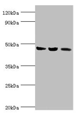 Western blot. All lanes: ACAT1 antibody at 6µg/ml. Lane 1: Mouse skeletal musce tissue. Lane 2: Rat heart tissue. Lane 3: THP-1 whole cell lysate. Secondary. Goat polyclonal to rabbit IgG at 1/10000 dilution. Predicted band size: 46, 18 kDa. Observed band size: 46 kDa