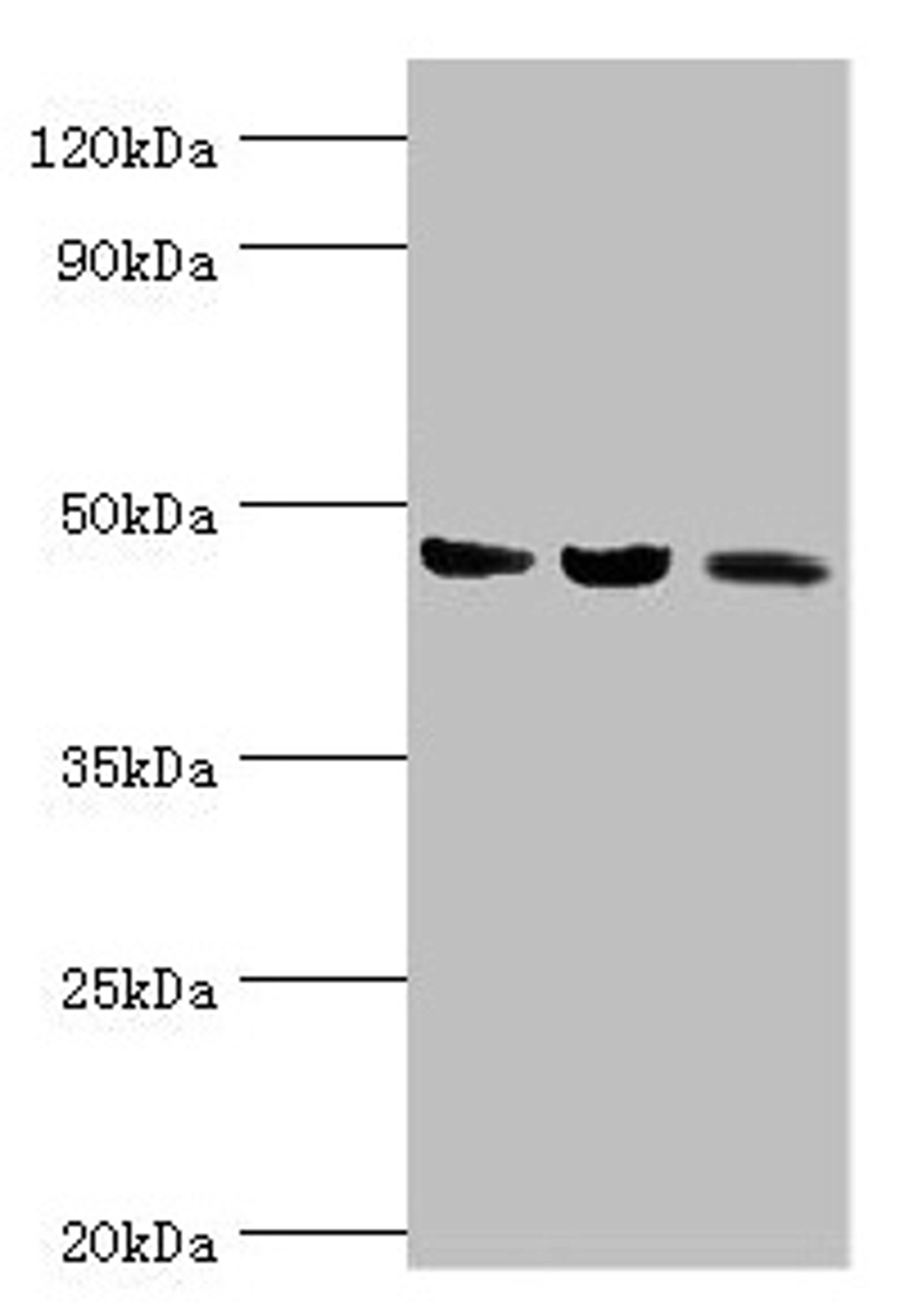 Western blot. All lanes: ACAT1 antibody at 6µg/ml. Lane 1: Mouse skeletal musce tissue. Lane 2: Rat heart tissue. Lane 3: THP-1 whole cell lysate. Secondary. Goat polyclonal to rabbit IgG at 1/10000 dilution. Predicted band size: 46, 18 kDa. Observed band size: 46 kDa