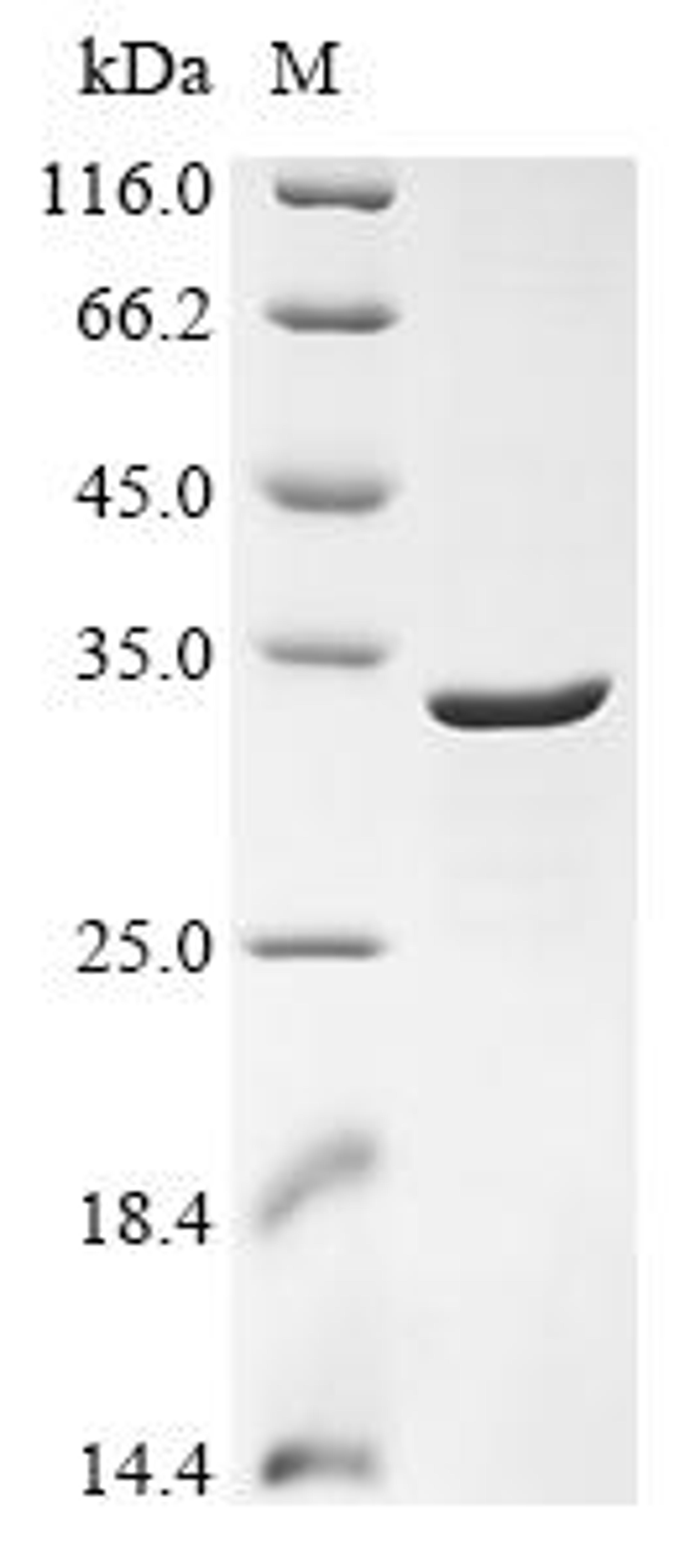 (Tris-Glycine gel) Discontinuous SDS-PAGE (reduced) with 5% enrichment gel and 15% separation gel.