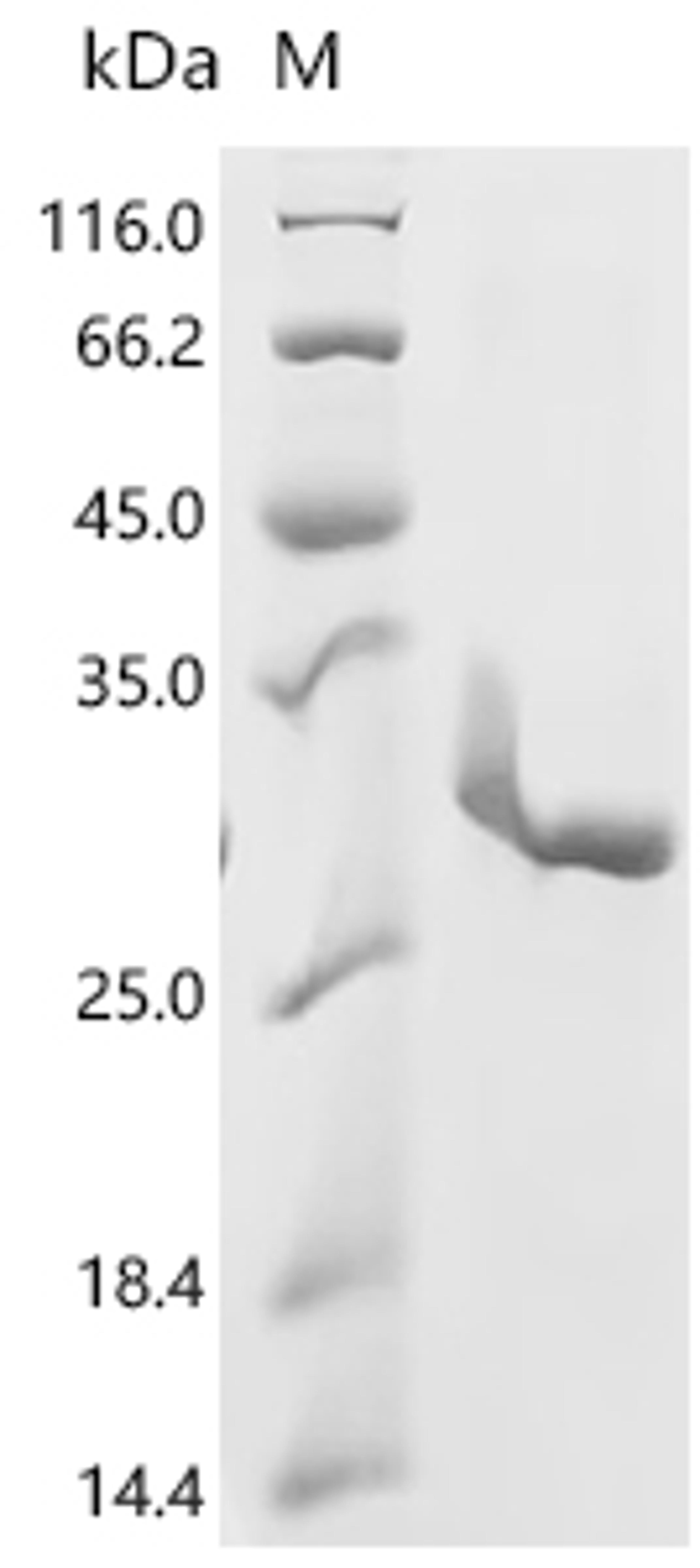 (Tris-Glycine gel) Discontinuous SDS-PAGE (reduced) with 5% enrichment gel and 15% separation gel.