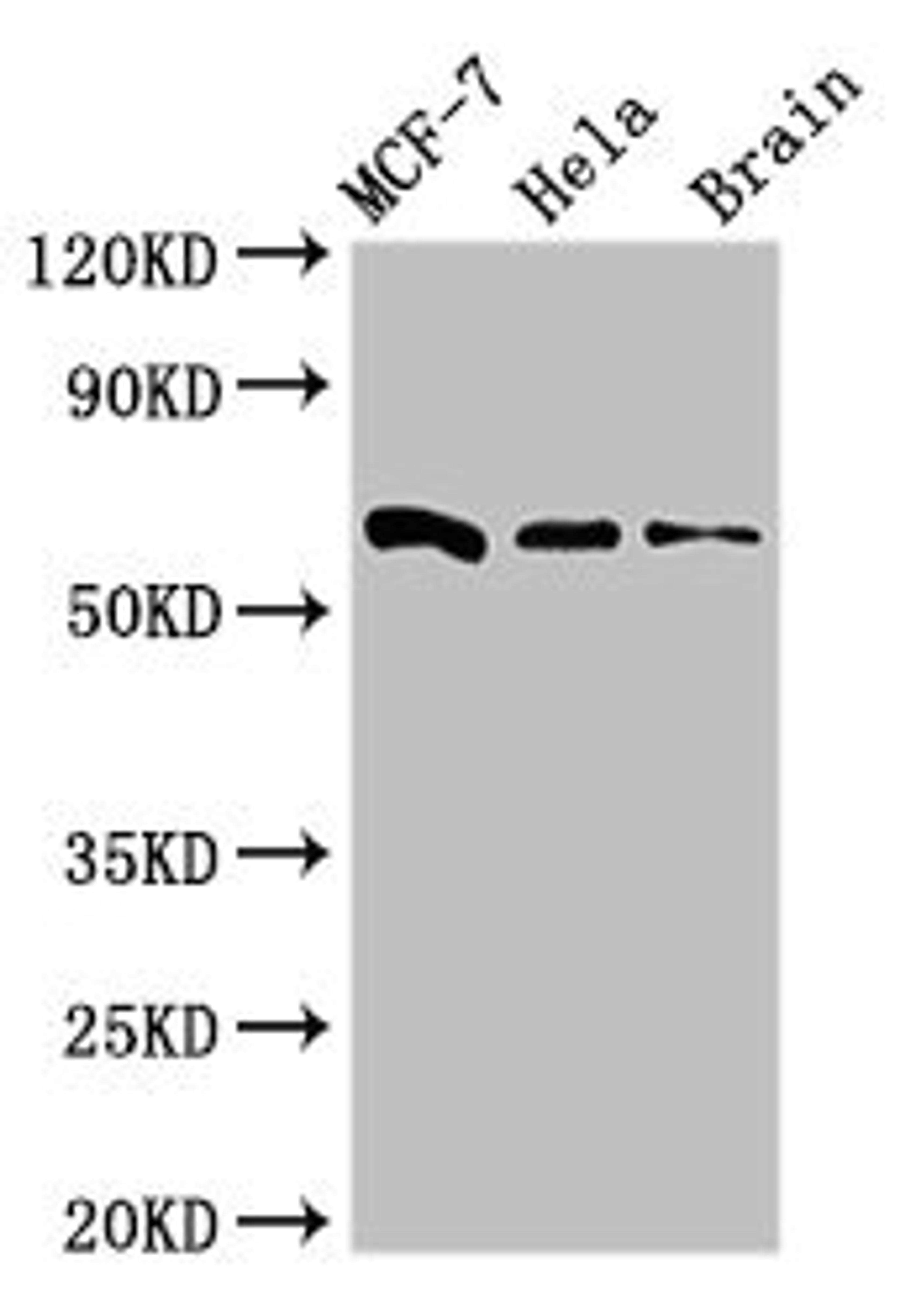 Western Blot. Positive WB detected in: MCF-7 whole cell lysate, Hela whole cell lysate, Mouse brain tissue. All lanes: SGO1 antibody at 3ug/ml. Secondary. Goat polyclonal to rabbit IgG at 1/50000 dilution. Predicted band size: 65, 36, 34, 32, 30, 61, 25 kDa. Observed band size: 65 kDa. 