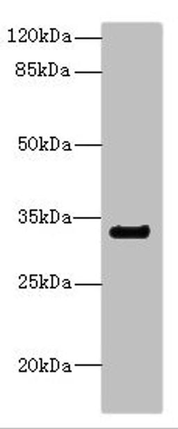 Western blot. All lanes: CNTN4 antibody IgG at 2.22ug/ml + Mouse kidney tissue. Secondary. Goat polyclonal to rabbit IgG at 1/10000 dilution. Predicted band size: 34, 21, 12, 17 kDa. Observed band size: 34 kDa. 