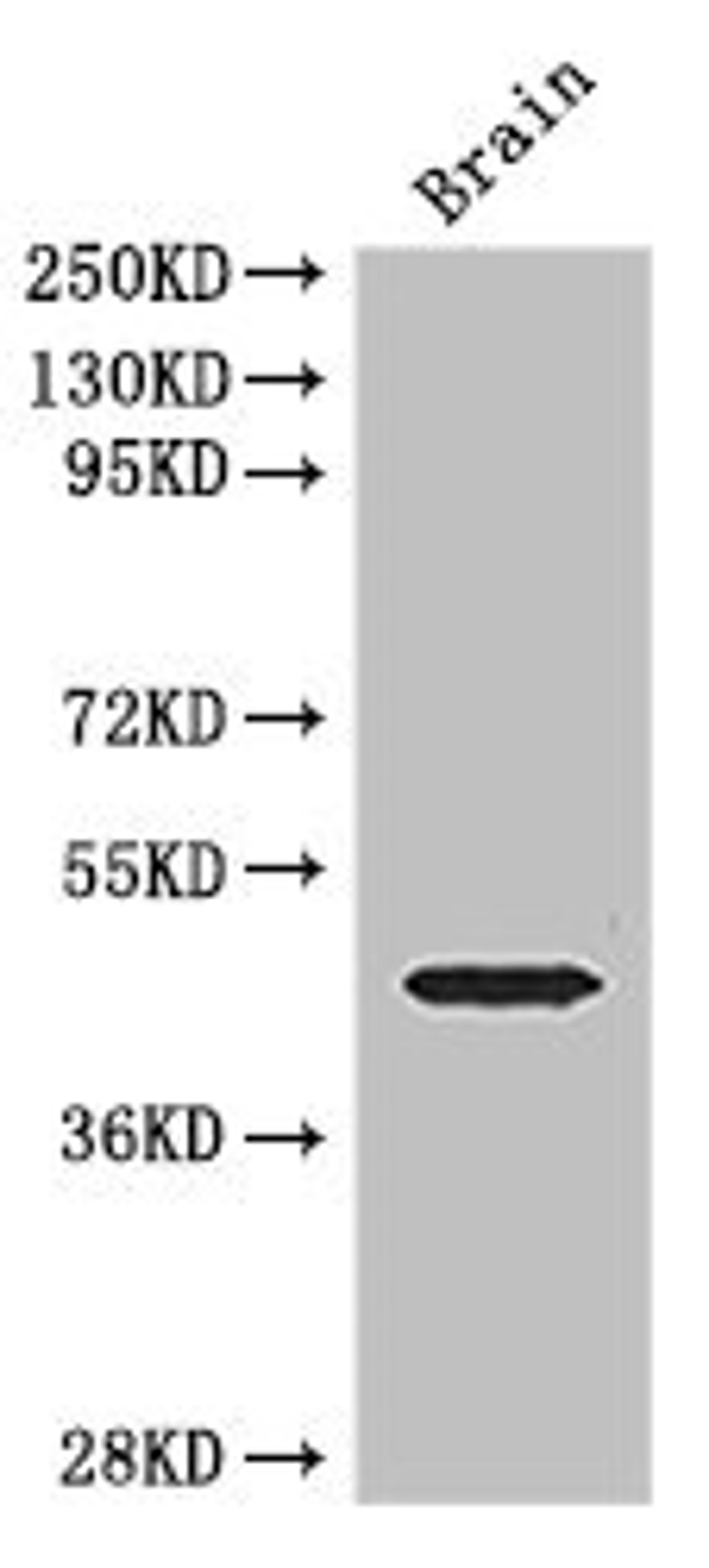Western Blot. Positive WB detected in: Mouse brain tissue. All lanes: ELK1 antibody at 3ug/ml. Secondary. Goat polyclonal to rabbit IgG at 1/50000 dilution. Predicted band size: 45, 12 kDa. Observed band size: 45 kDa. 