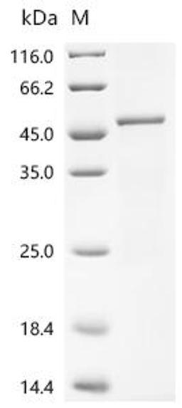 (Tris-Glycine gel) Discontinuous SDS-PAGE (reduced) with 5% enrichment gel and 15% separation gel.