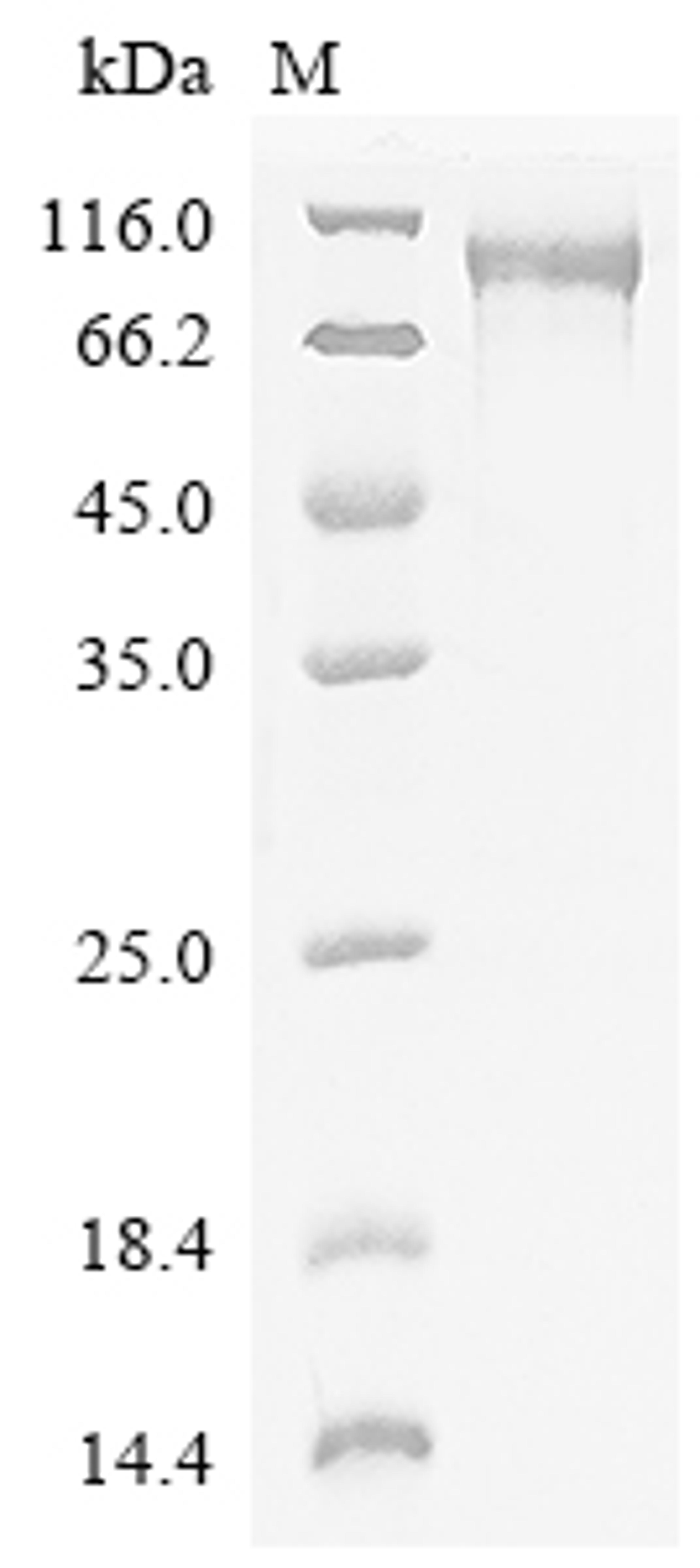 (Tris-Glycine gel) Discontinuous SDS-PAGE (reduced) with 5% enrichment gel and 15% separation gel.