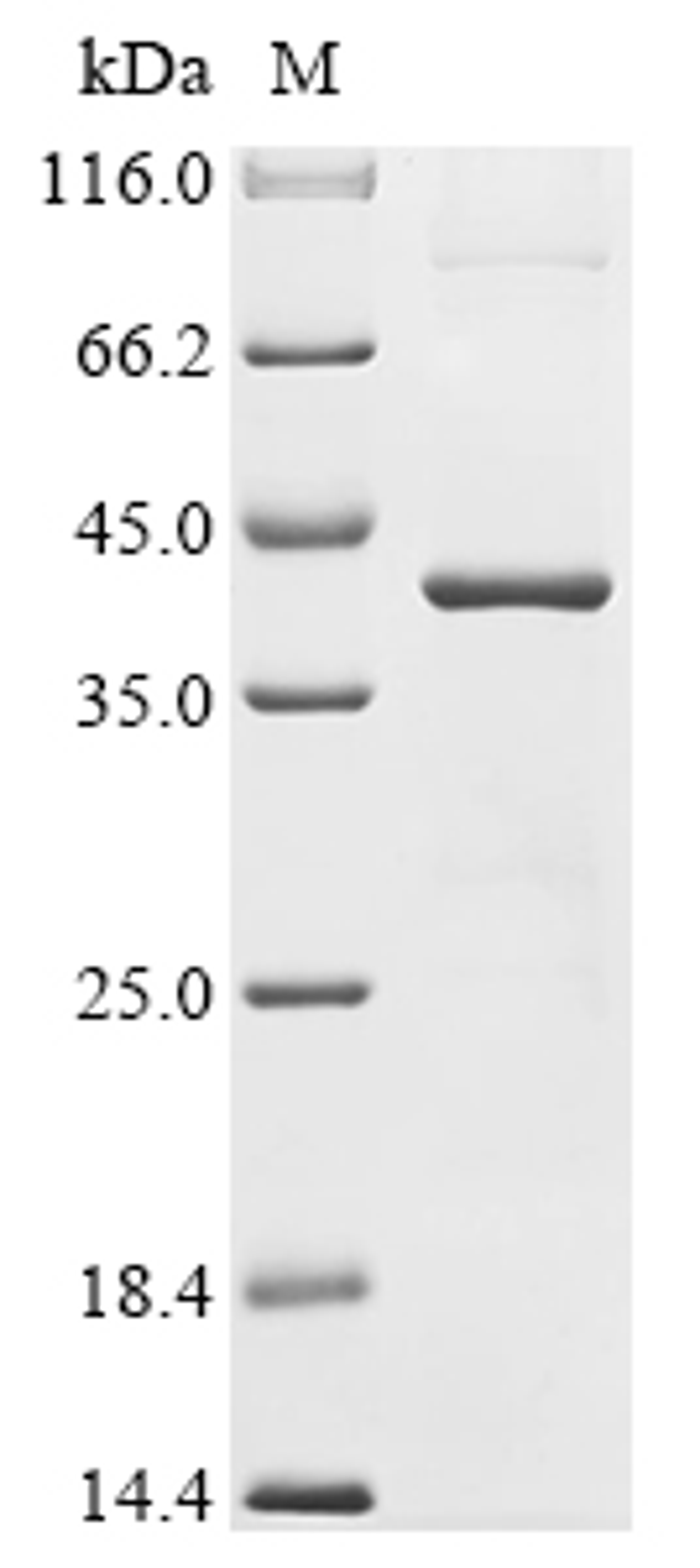(Tris-Glycine gel) Discontinuous SDS-PAGE (reduced) with 5% enrichment gel and 15% separation gel.