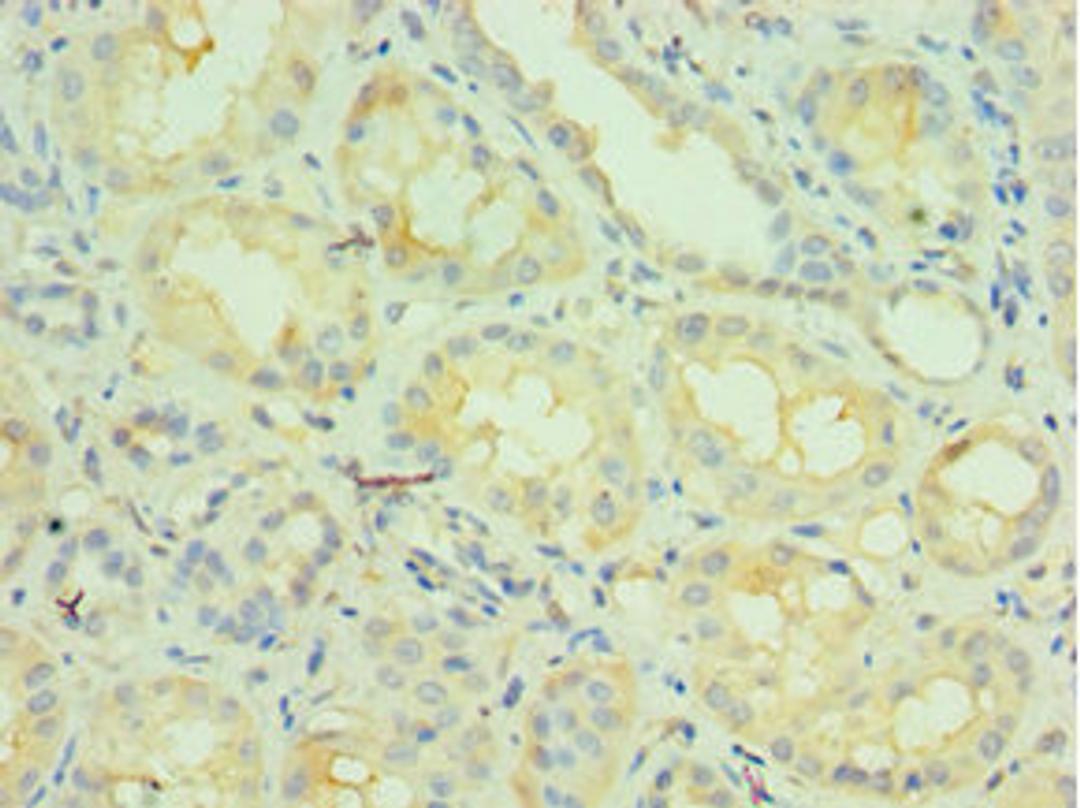 Immunohistochemistry of paraffin-embedded human kidney tissue using CSB-PA015542ESR1HU at dilution of 1:100