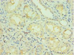 Immunohistochemistry of paraffin-embedded human kidney tissue using CSB-PA015542ESR1HU at dilution of 1:100