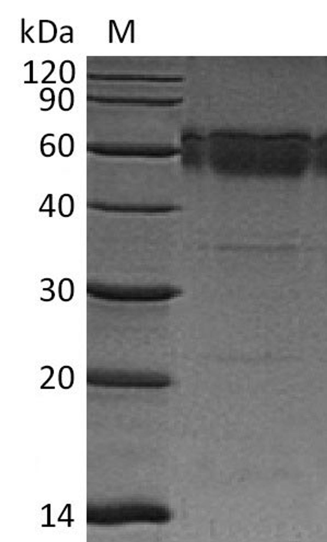 (Tris-Glycine gel) Discontinuous SDS-PAGE (reduced) with 5% enrichment gel and 15% separation gel.
