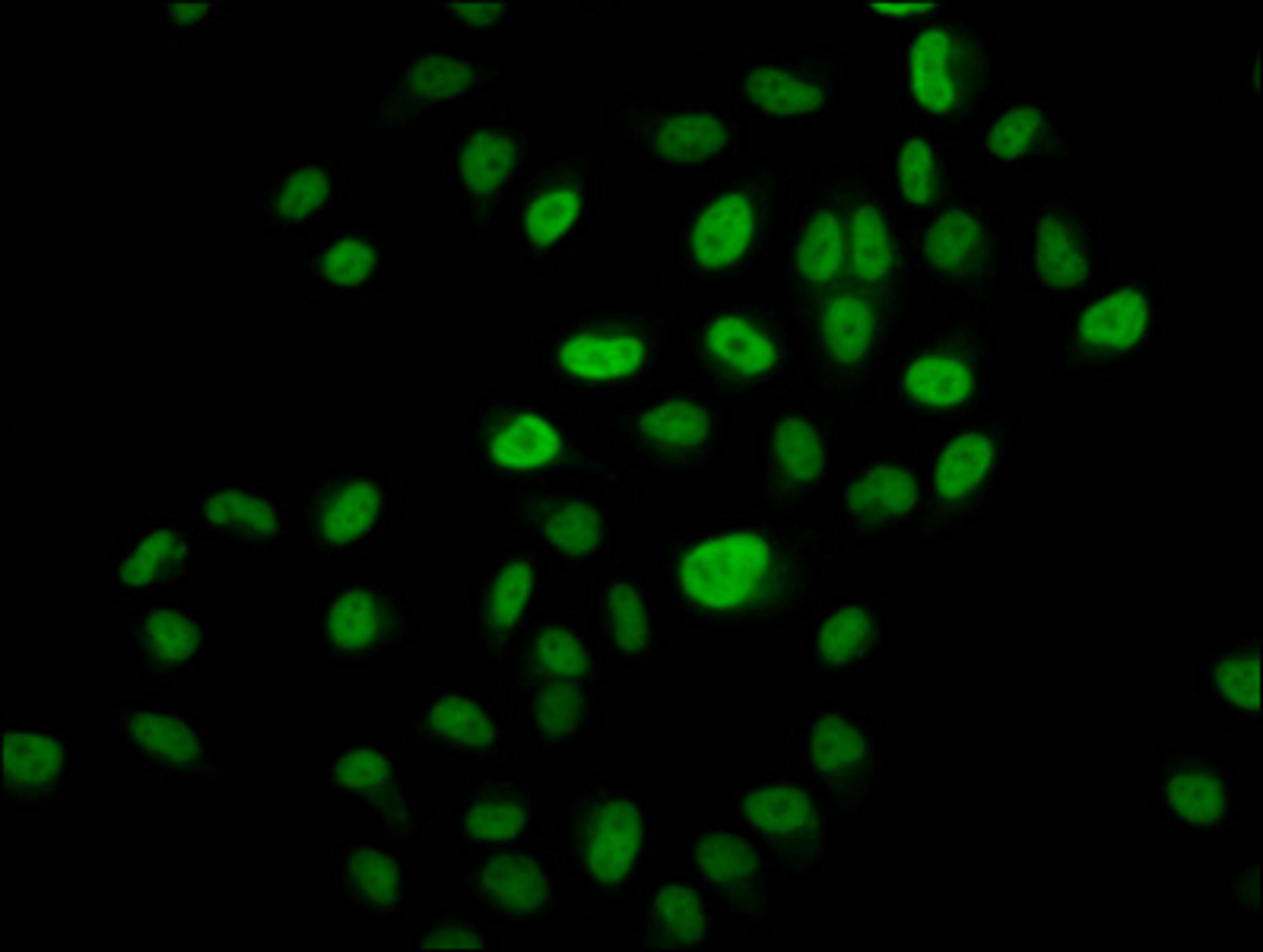 Immunofluorescence staining of Hela cells (treated with 30mM sodium butyrate for 4h) with CSB-PA010418OA14hibHU at 1:10, counter-stained with DAPI. The cells were fixed in 4% formaldehyde, permeabilized using 0.2% Triton X-100 and blocked in 10% normal Goat Serum. The cells were then incubated with the antibody overnight at 4°C. The secondary antibody was Alexa Fluor 488-congugated AffiniPure Goat Anti-Rabbit IgG(H+L).