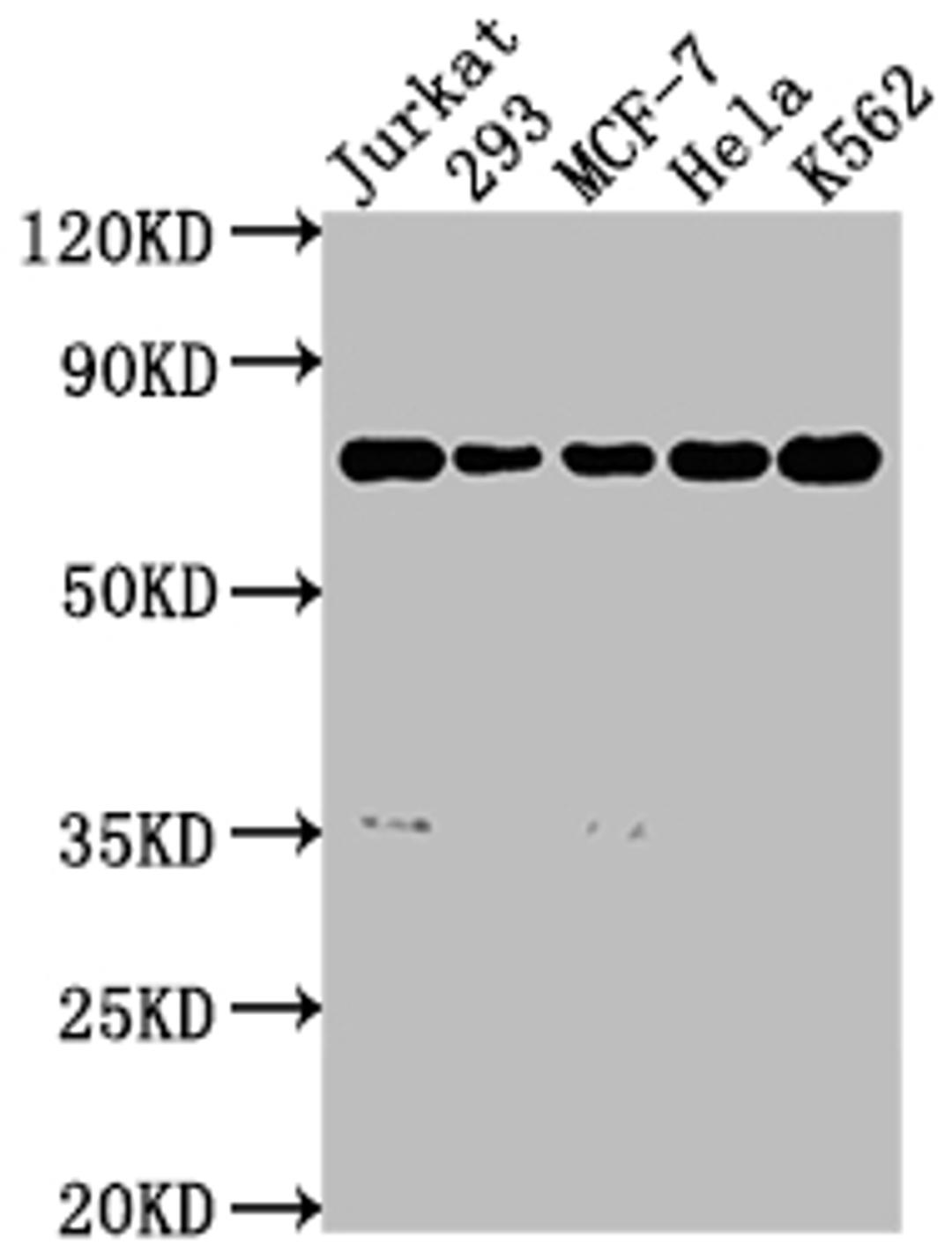 Western Blot. Positive WB detected in: Jurkat whole cell lysate, 293 whole cell lysate, MCF-7 whole cell lysate, Hela whole cell lysate, K562 whole cell lysate. All lanes: PTPN11 antibody at 1:2000. Secondary. Goat polyclonal to rabbit IgG at 1/50000 dilution. Predicted band size: 69, 53 kDa. Observed band size: 69 kDa. 