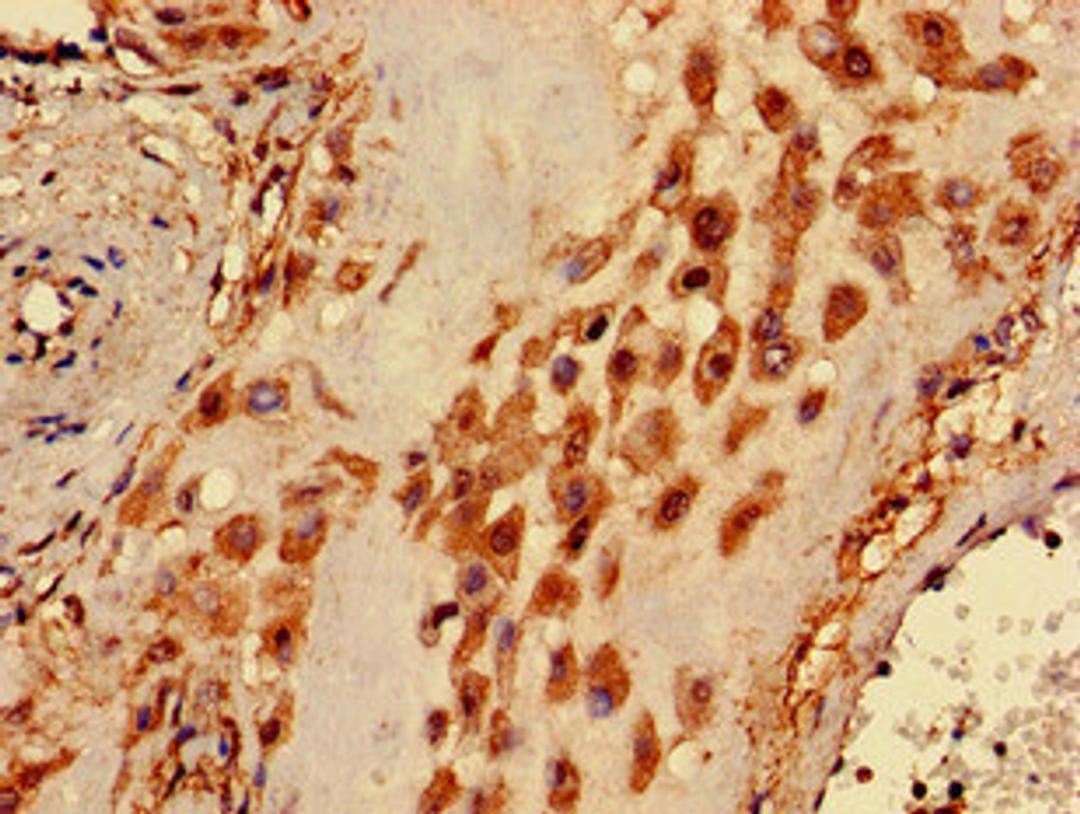 Immunohistochemistry of paraffin-embedded human placenta tissue using CSB-PA017965LA01HU at dilution of 1:100