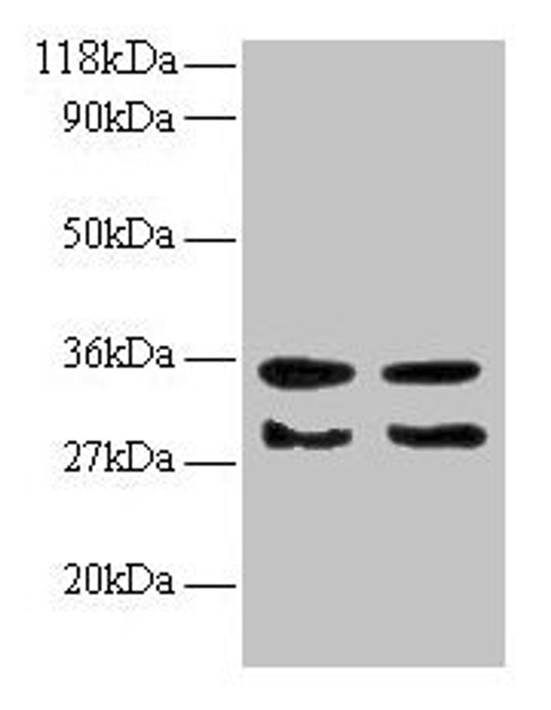 Western blot. All lanes: TGFA antibody at 2µg/ml. Lane 1: EC109 whole cell lysate. Lane 2: 293T whole cell lysate. Secondary. Goat polyclonal to rabbit IgG at 1/15000 dilution. Predicted band size: 18, 17 kDa. Observed band size: 30, 35 kDa