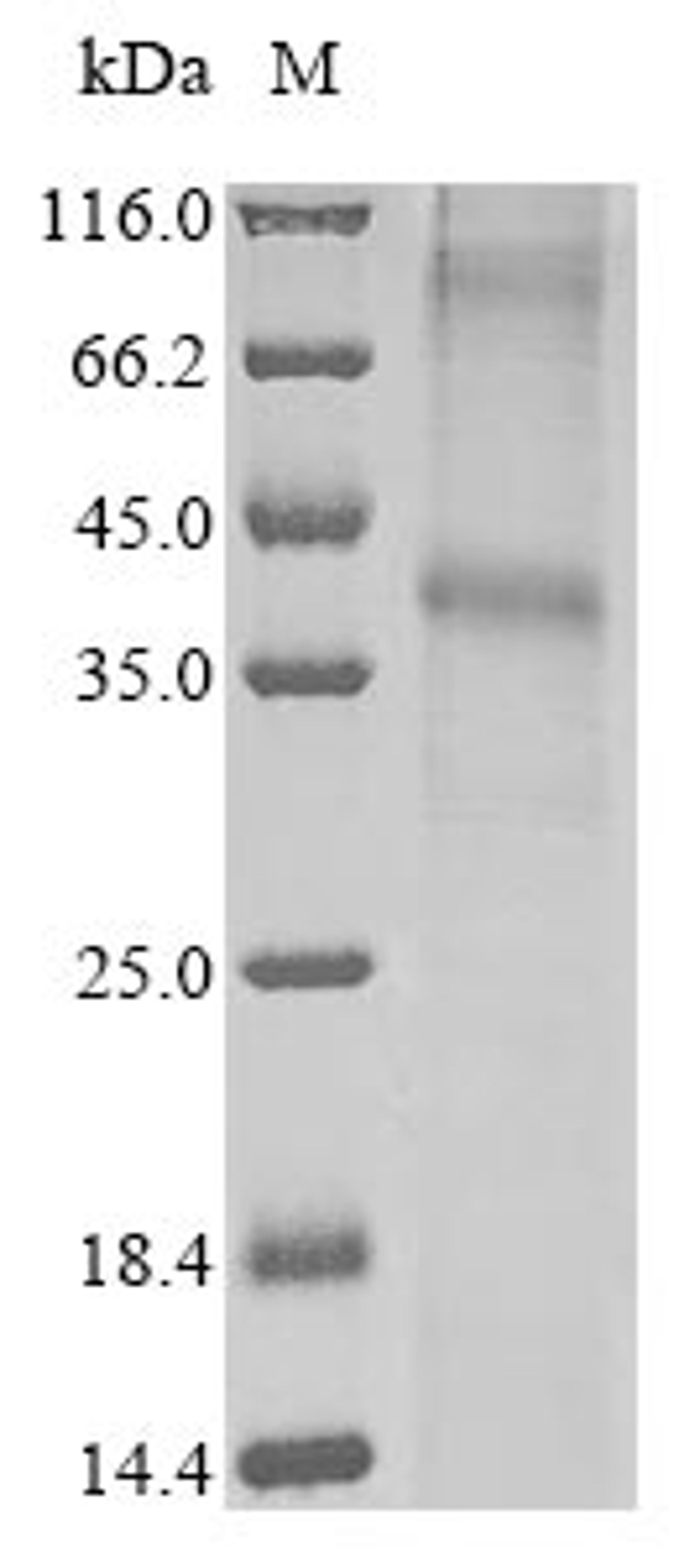 (Tris-Glycine gel) Discontinuous SDS-PAGE (reduced) with 5% enrichment gel and 15% separation gel.