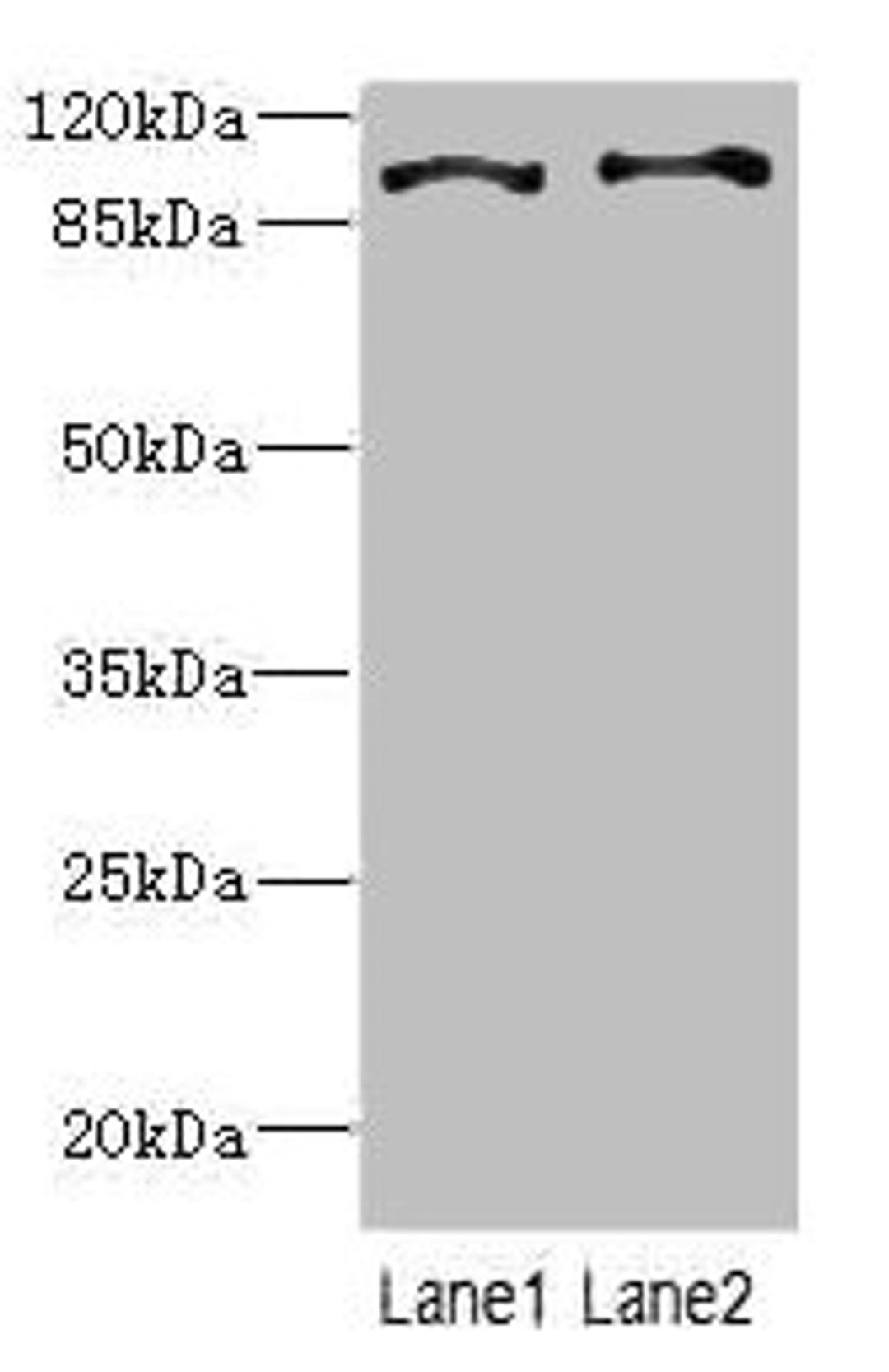 Western blot. All lanes: CCP110 antibody at 4.6ug/ml. Lane 1: Hela whole cell lysate. Lane 2: 293T whole cell lysate. Secondary. Goat polyclonal to rabbit IgG at 1/10000 dilution. Predicted band size: 114, 112 kDa. Observed band size: 114 kDa. 