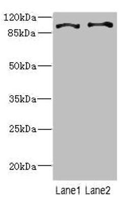 Western blot. All lanes: CCP110 antibody at 4.6ug/ml. Lane 1: Hela whole cell lysate. Lane 2: 293T whole cell lysate. Secondary. Goat polyclonal to rabbit IgG at 1/10000 dilution. Predicted band size: 114, 112 kDa. Observed band size: 114 kDa. 