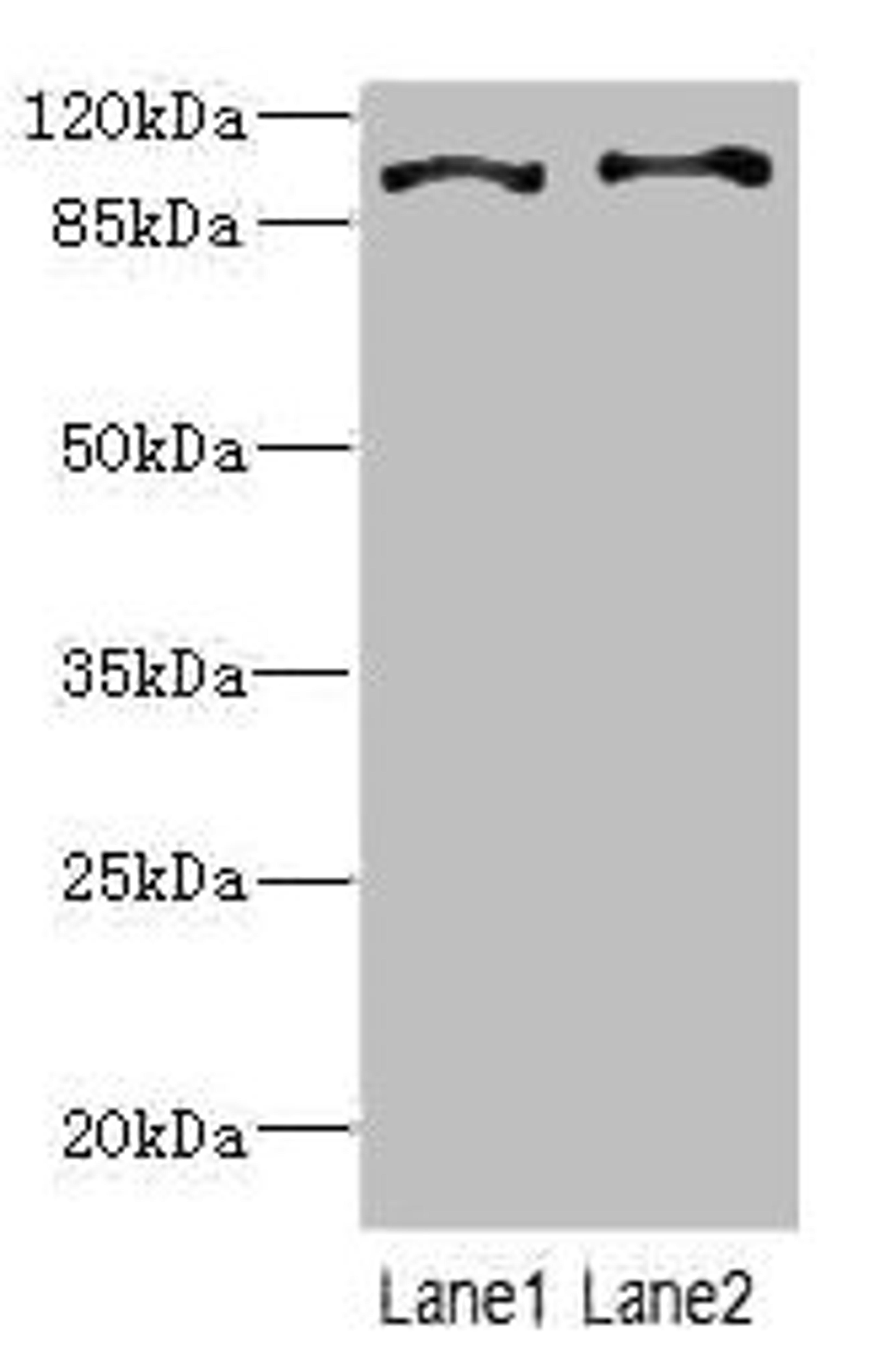 Western blot. All lanes: CCP110 antibody at 4.6ug/ml. Lane 1: Hela whole cell lysate. Lane 2: 293T whole cell lysate. Secondary. Goat polyclonal to rabbit IgG at 1/10000 dilution. Predicted band size: 114, 112 kDa. Observed band size: 114 kDa. 