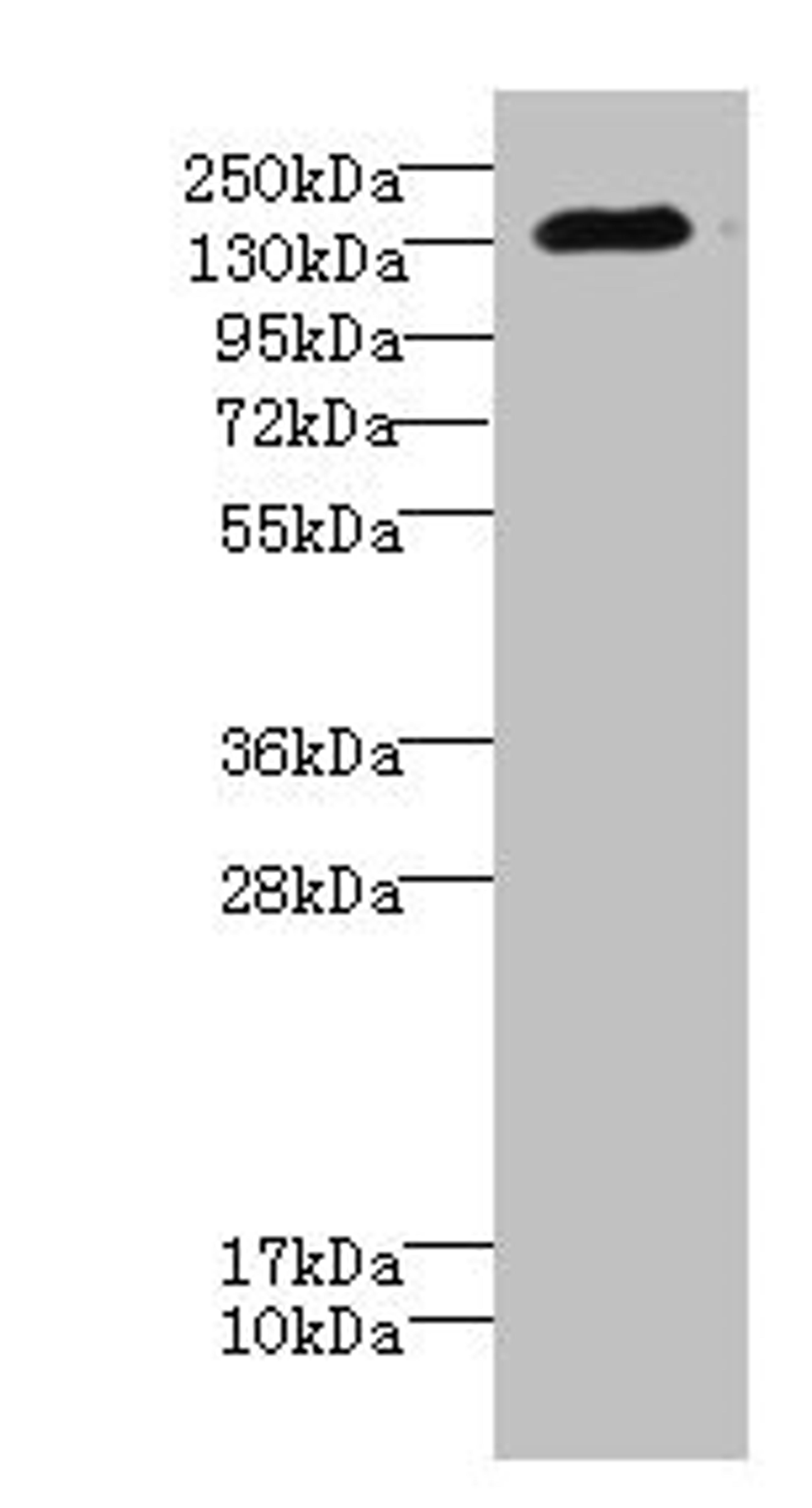 Western blot. All lanes: CACNA2D2 antibody IgG at 4.51ug/ml + Mouse brain tissue. Secondary. Goat polyclonal to rabbit IgG at 1/10000 dilution. Predicted band size: 130, 123, 131 kDa. Observed band size: 130 kDa. 