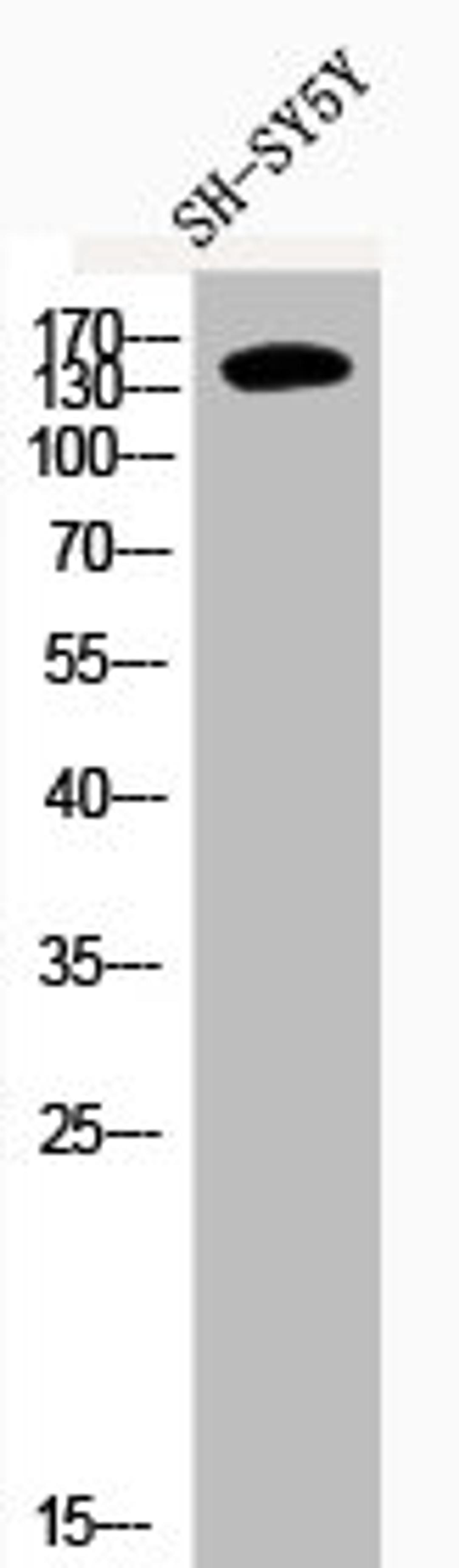 Western Blot analysis of SH-SY5Y cells using Phospho-IRS-1 (S636) Polyclonal Antibody