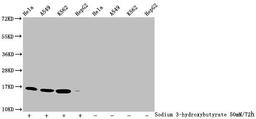 Western Blot. Detected samples: Hela whole cell lysate, A549 whole cell lysate, K562 whole cell lysate, HepG2 whole cell lysate; Untreated (-) or treated (+) with 50mM sodium 3-hydroxybutyrate for 72h. All lanes: HIST1H3A antibody at 1:2000. Secondary. Goat polyclonal to rabbit IgG at 1/40000 dilution. Predicted band size: 16 kDa. Observed band size: 16 kDa