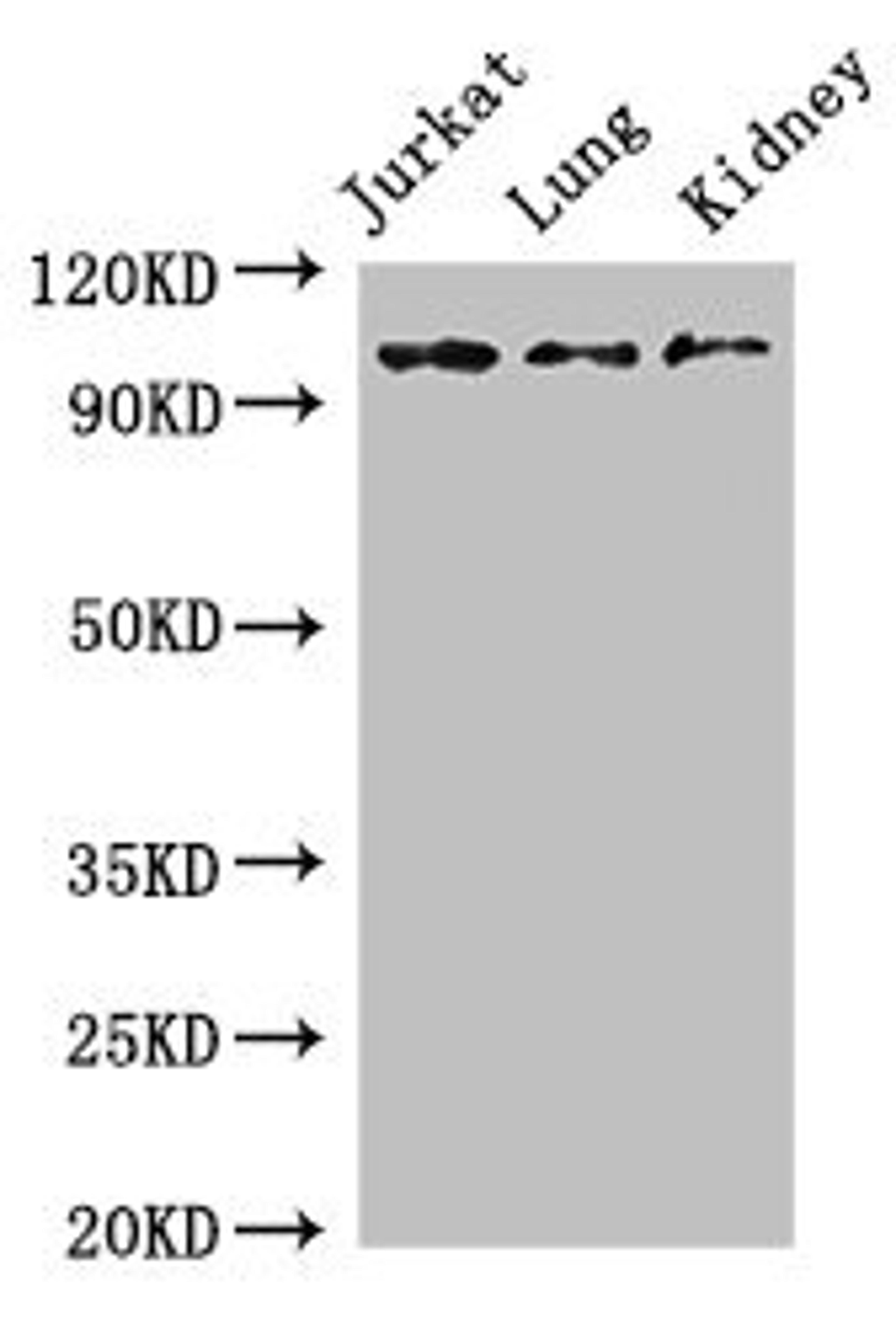 Western Blot. Positive WB detected in: Jurkat whole cell lysate, Mouse lung tissue, Mouse kidney tissue. All lanes: SMARCAL1 antibody at 3ug/ml. Secondary. Goat polyclonal to rabbit IgG at 1/50000 dilution. Predicted band size: 106 kDa. Observed band size: 106 kDa. 