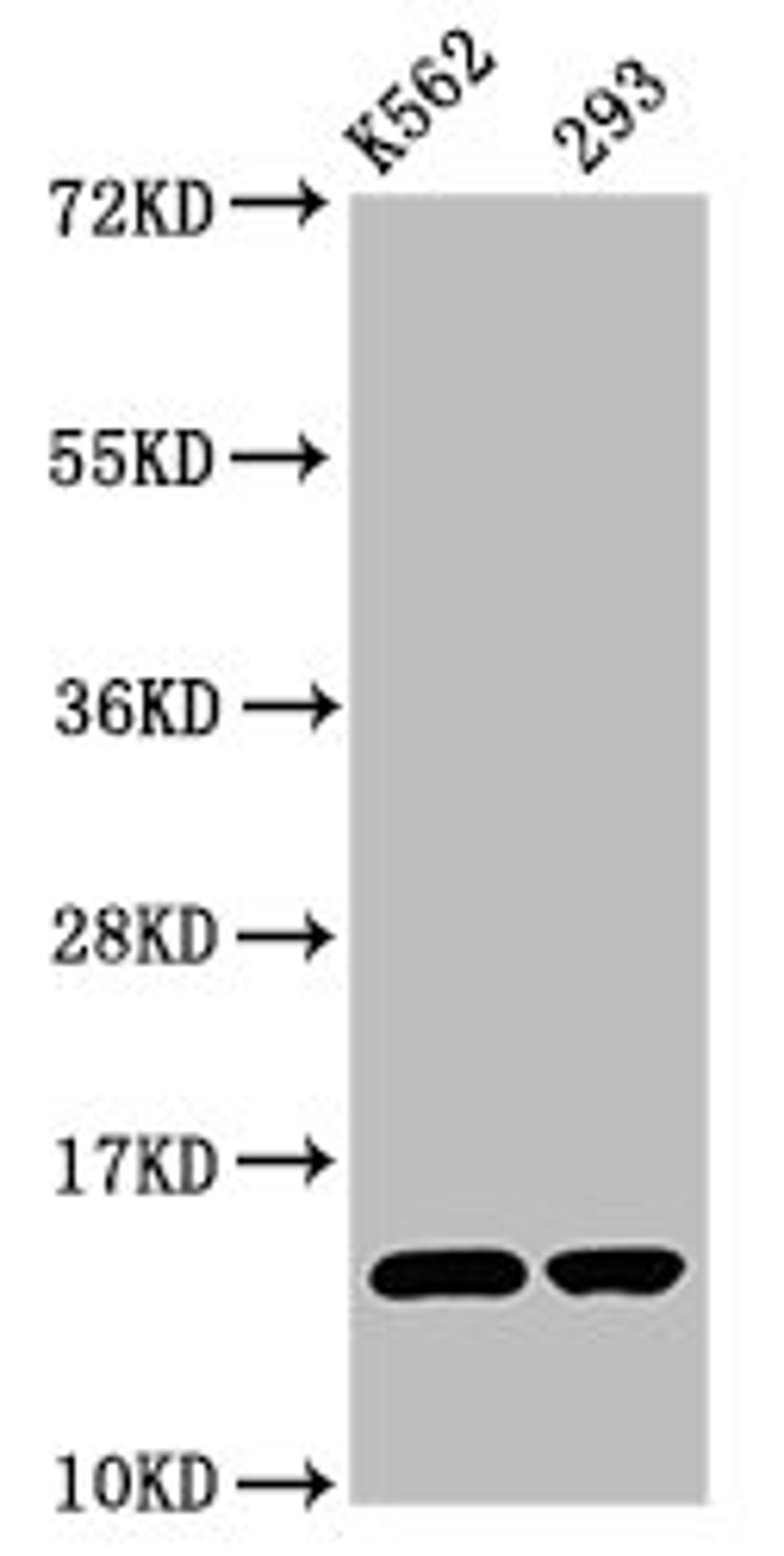 Western Blot. Positive WB detected in: K562 whole cell lysate, 293 whole cell lysate. All lanes: HIST1H2BC antibody at 0.72µg/ml. Secondary. Goat polyclonal to rabbit IgG at 1/50000 dilution. Predicted band size: 14 kDa. Observed band size: 14 kDa