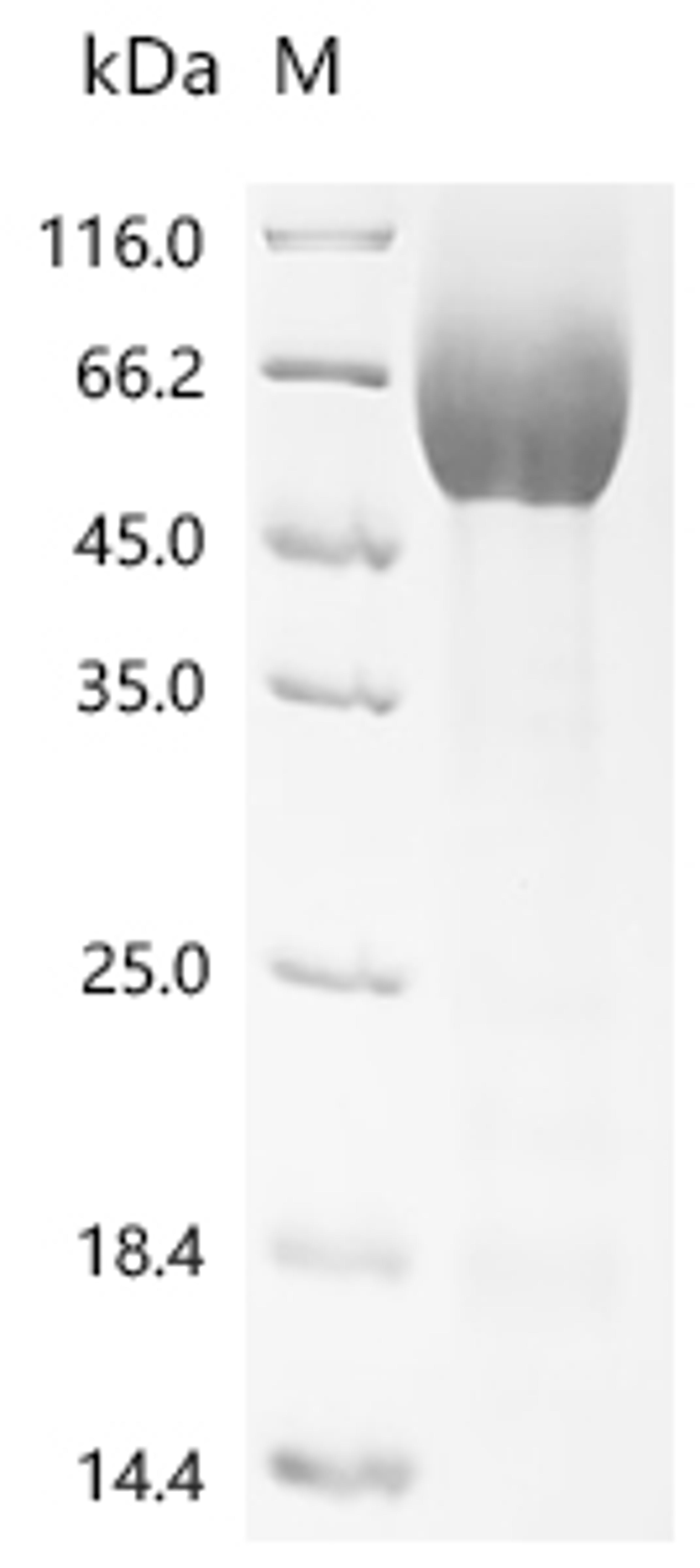 (Tris-Glycine gel) Discontinuous SDS-PAGE (reduced) with 5% enrichment gel and 15% separation gel.