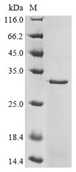 (Tris-Glycine gel) Discontinuous SDS-PAGE (reduced) with 5% enrichment gel and 15% separation gel.