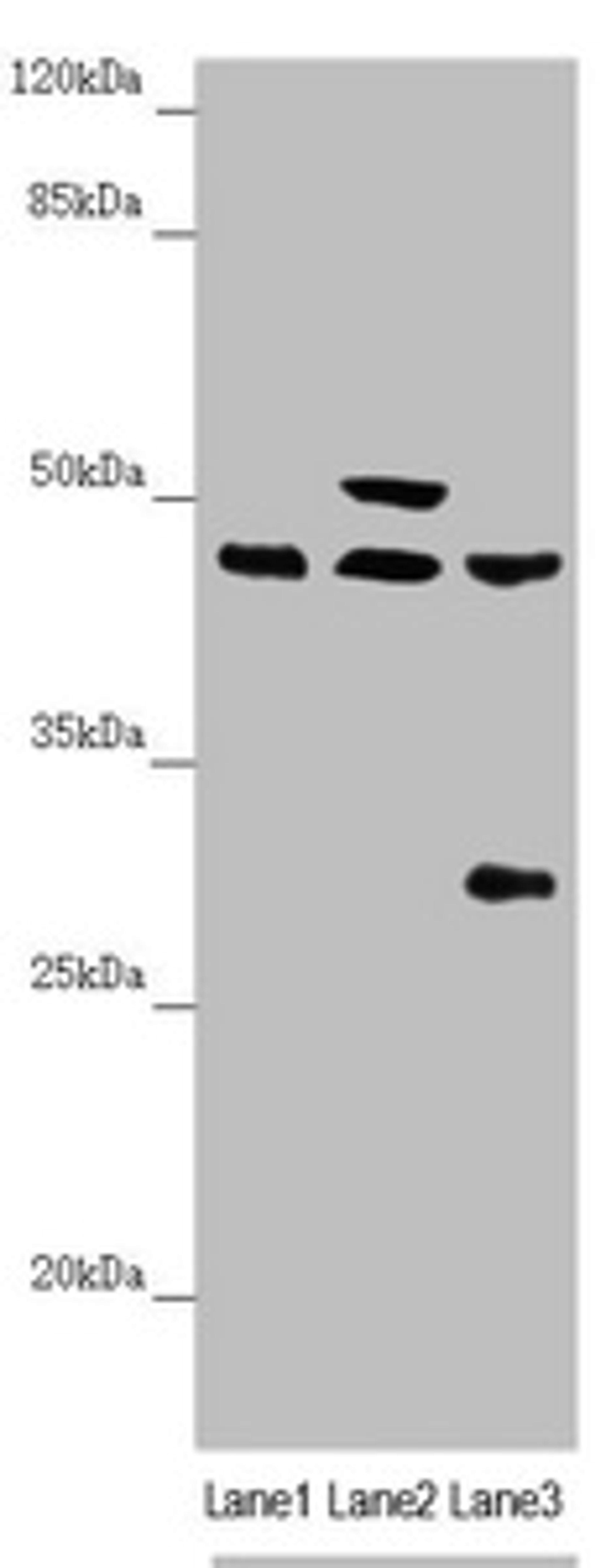 Western blot. All lanes: HAUS8 antibody at 2.35 ug/ml. Lane 1: Mouse kidney tissue. Lane 2: Mouse brain tissue. Lane 3: A549 whole cell lysate. Secondary. Goat polyclonal to rabbit IgG at 1/10000 dilution. Predicted band size: 45, 39 kDa. Observed band size: 45, 50, 28 kDa. 