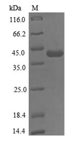 (Tris-Glycine gel) Discontinuous SDS-PAGE (reduced) with 5% enrichment gel and 15% separation gel.