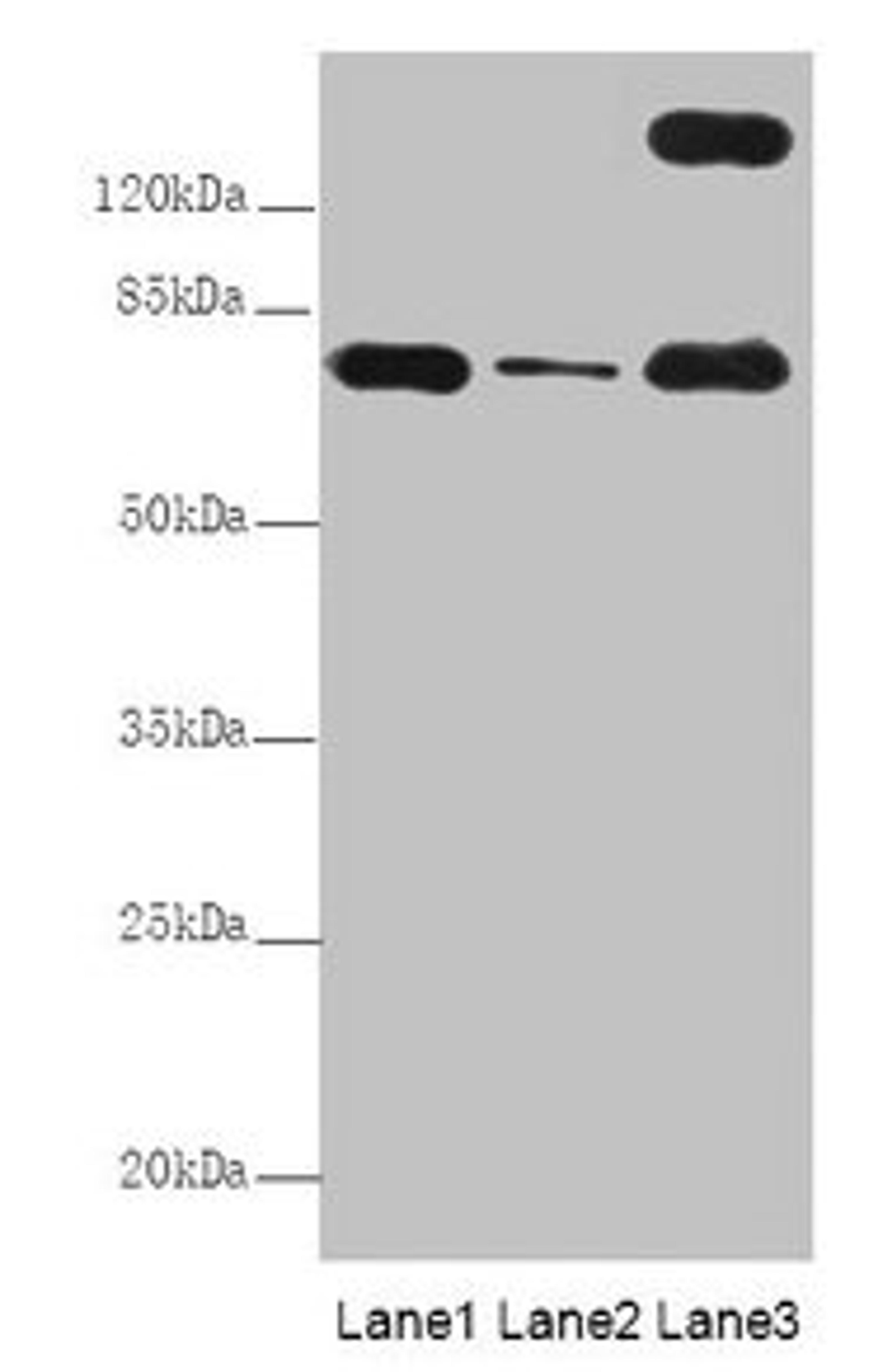 Western Blot. All lanes: TTC12 antibody at 8µg/ml. Lane 1: Mouse large intestine tissue. Lane 2: Mouse small intestine tissue. Lane 3: HepG2 whole cell lysate. Secondary. Goat polyclonal to rabbit IgG at 1/10000 dilution. Predicted band size: 79, 82 kDa. Observed band size: 79, 170 kDa