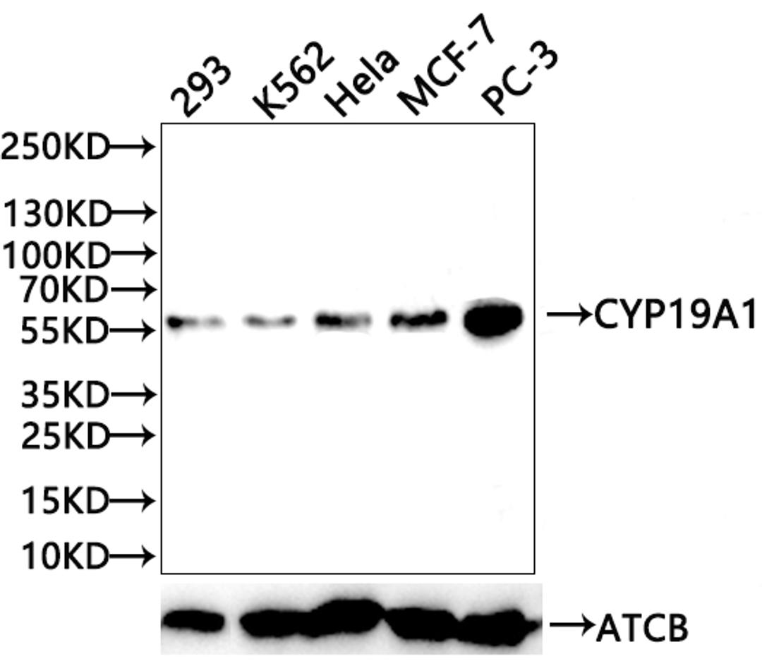 Western Blot. Positive WB detected in: HepG2 whole cell lysate, Jurkat whole cell lysate, 293 whole cell lysate, SH-SY5Y whole cell lysate, U87 whole cell lysate, K562 whole cell lysate. All lanes: CYP19A1 antibody at 2.3μg/ml. Secondary. Goat polyclonal to rabbit IgG at 1/50000 dilution. Predicted band size: 58, 25 KDa. Observed band size: 58 KDa. 