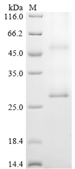 (Tris-Glycine gel) Discontinuous SDS-PAGE (reduced) with 5% enrichment gel and 15% separation gel.
