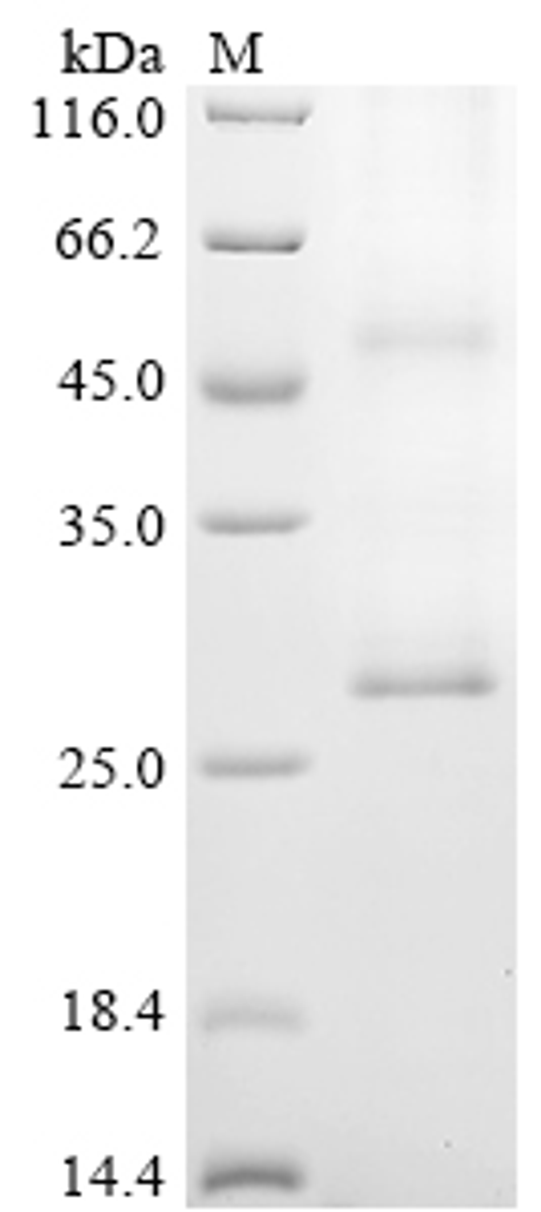 (Tris-Glycine gel) Discontinuous SDS-PAGE (reduced) with 5% enrichment gel and 15% separation gel.