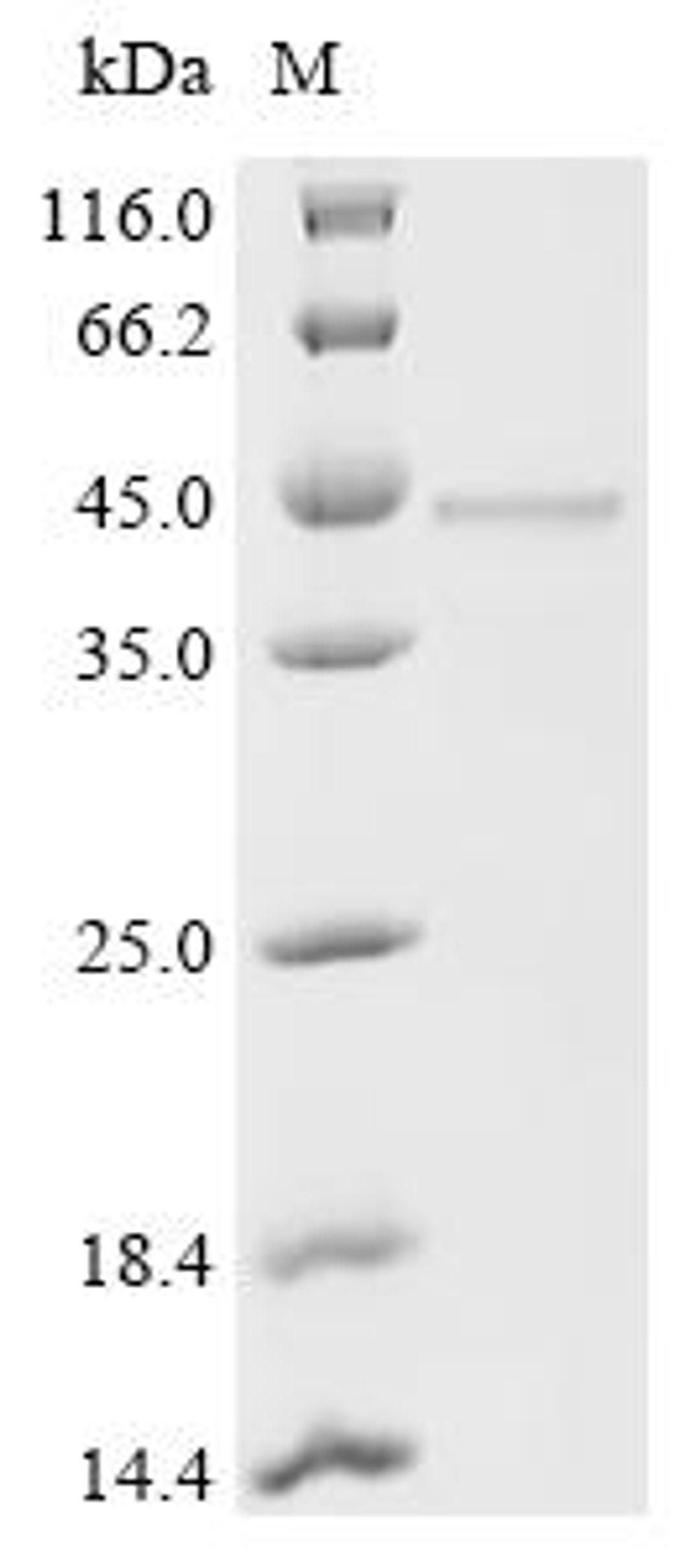 (Tris-Glycine gel) Discontinuous SDS-PAGE (reduced) with 5% enrichment gel and 15% separation gel.
