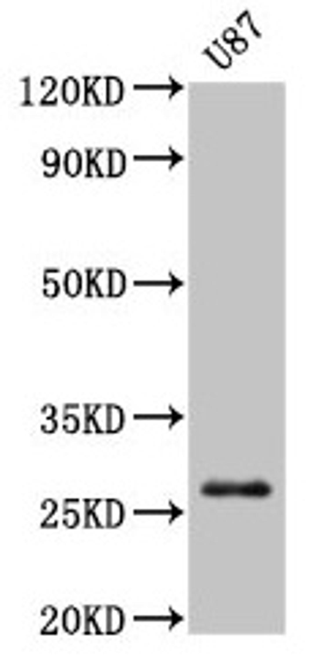 Western Blot. Positive WB detected in: U87 whole cell lysate. All lanes: PRSS3 antibody at 3µg/ml. Secondary. Goat polyclonal to rabbit IgG at 1/50000 dilution. Predicted band size: 33, 29, 27, 26 kDa. Observed band size: 27 kDa