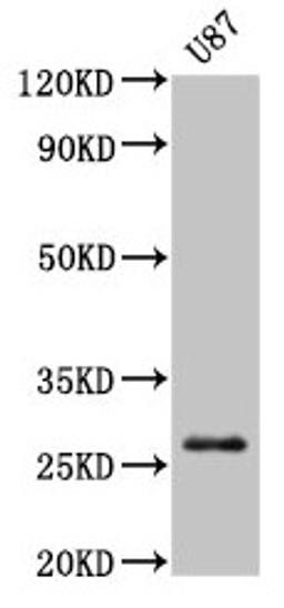 Western Blot. Positive WB detected in: U87 whole cell lysate. All lanes: PRSS3 antibody at 3µg/ml. Secondary. Goat polyclonal to rabbit IgG at 1/50000 dilution. Predicted band size: 33, 29, 27, 26 kDa. Observed band size: 27 kDa