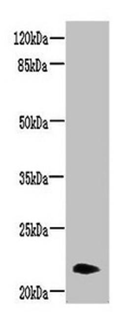Western blot. All lanes: NRSN2 antibody at 3ug/ml + Mouse liver tissue. Secondary. Goat polyclonal to rabbit IgG at 1/10000 dilution. Predicted band size: 22 kDa. Observed band size: 22 kDa. 