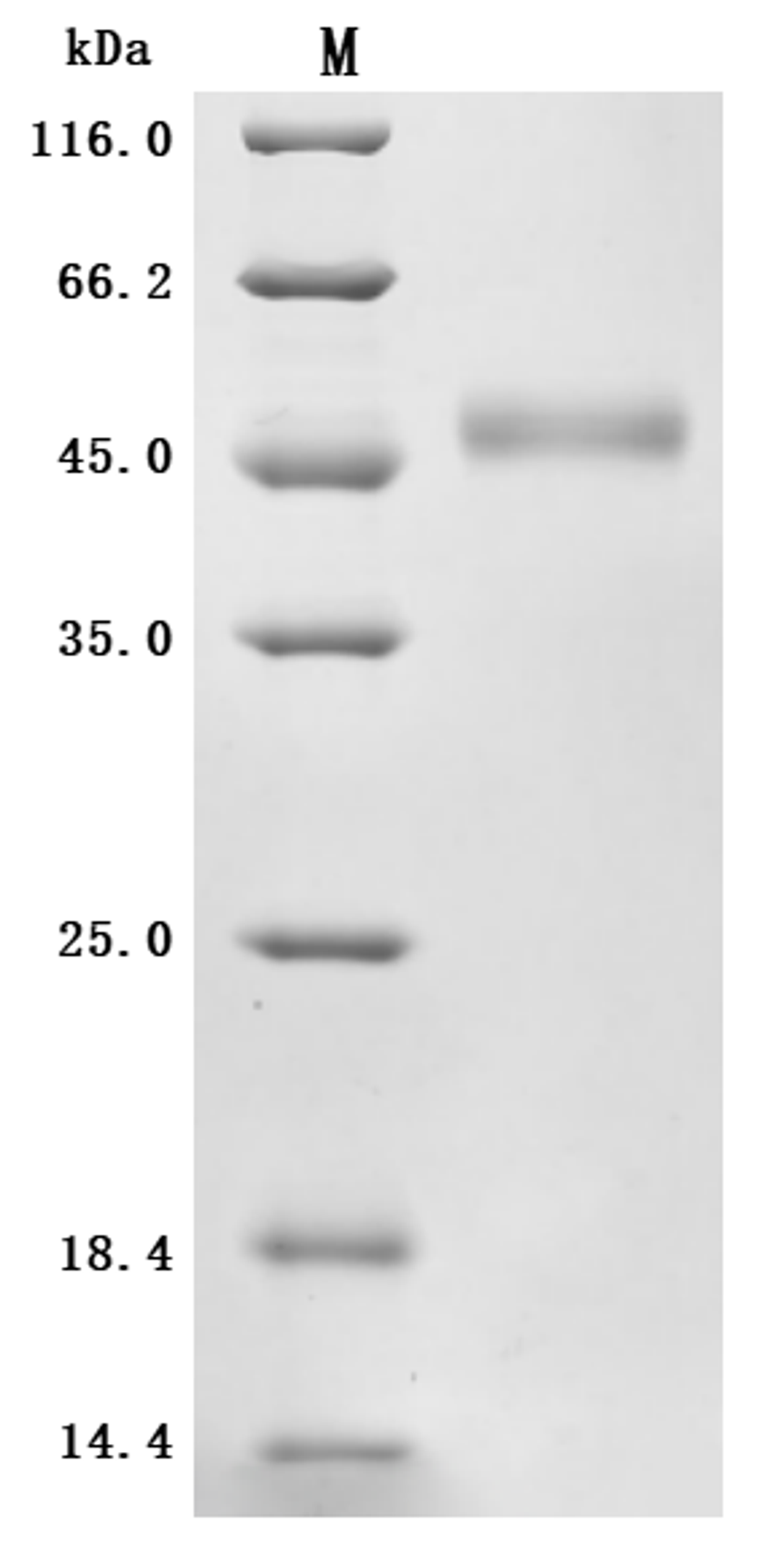 (Tris-Glycine gel) Discontinuous SDS-PAGE (reduced) with 5% enrichment gel and 15% separation gel.