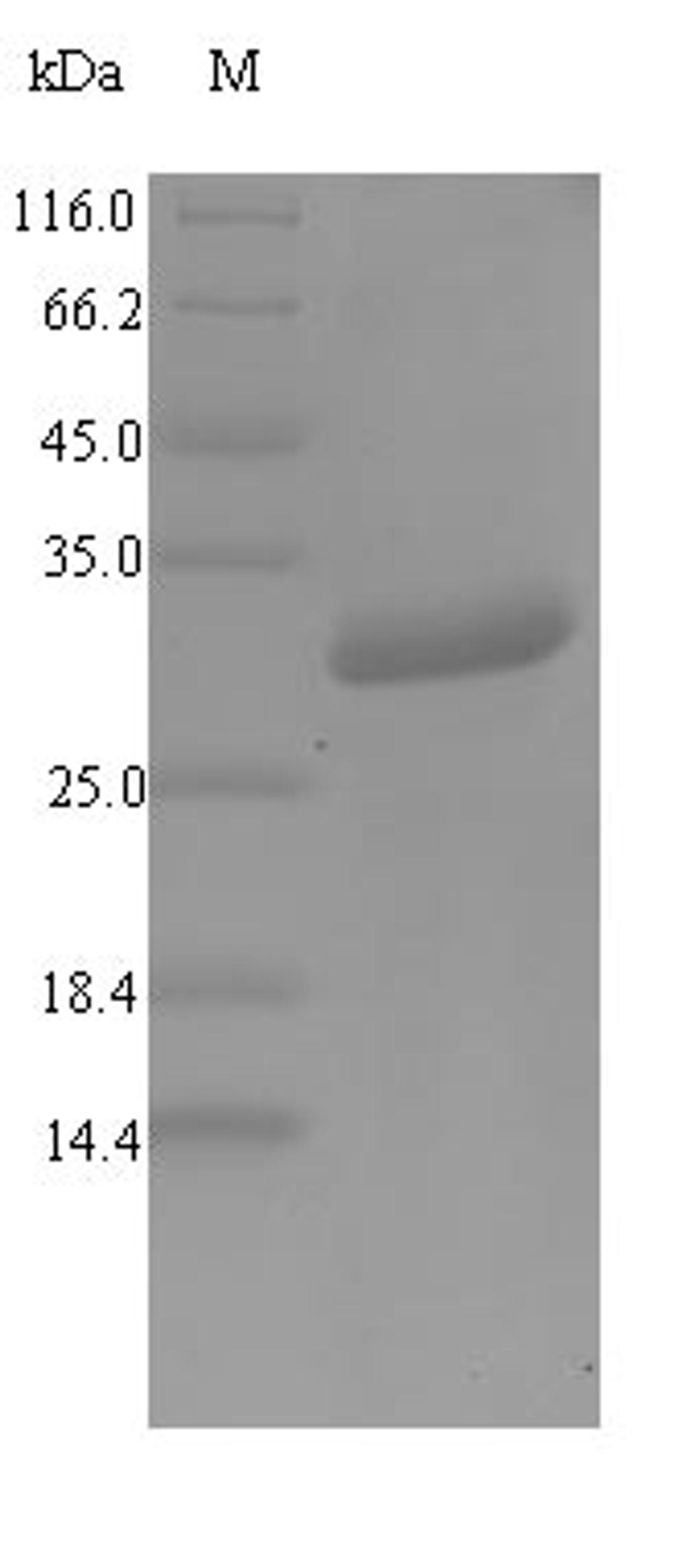 (Tris-Glycine gel) Discontinuous SDS-PAGE (reduced) with 5% enrichment gel and 15% separation gel.